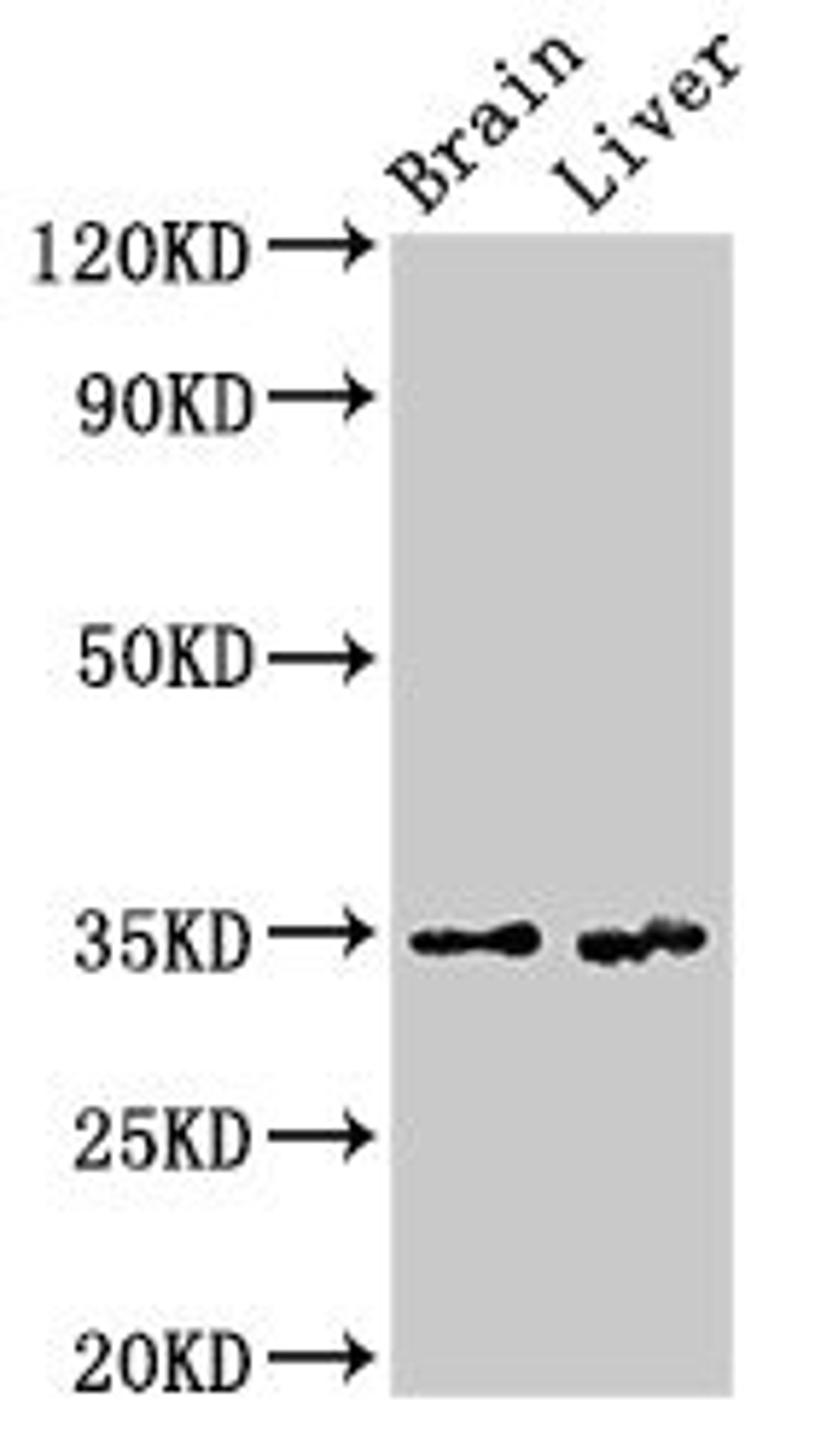 Western Blot. Positive WB detected in: Rat brain tissue, Rat liver tissue. All lanes: RBKS antibody at 3.4µg/ml. Secondary. Goat polyclonal to rabbit IgG at 1/50000 dilution. Predicted band size: 35, 31 kDa. Observed band size: 35 kDa