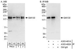 Detection of human GM130 by western blot and immunoprecipitation.