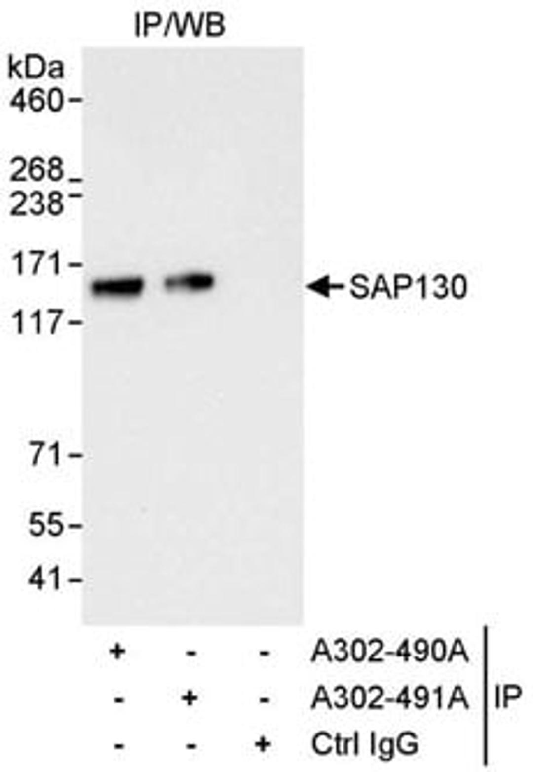 Detection of human SAP130 by western blot of immunoprecipitates.