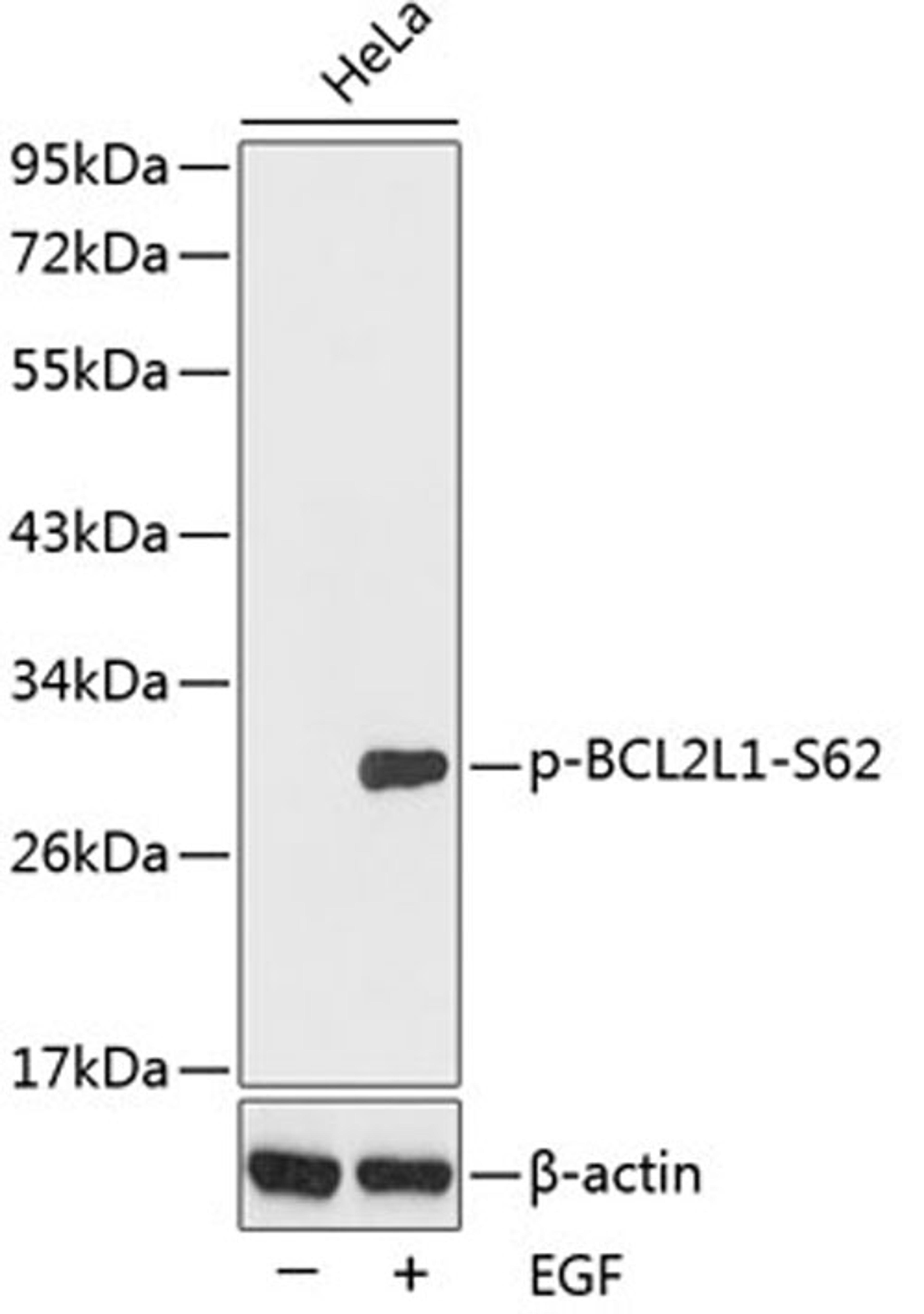 Western blot - Phospho-BCL2L1-S62 antibody (AP0314)