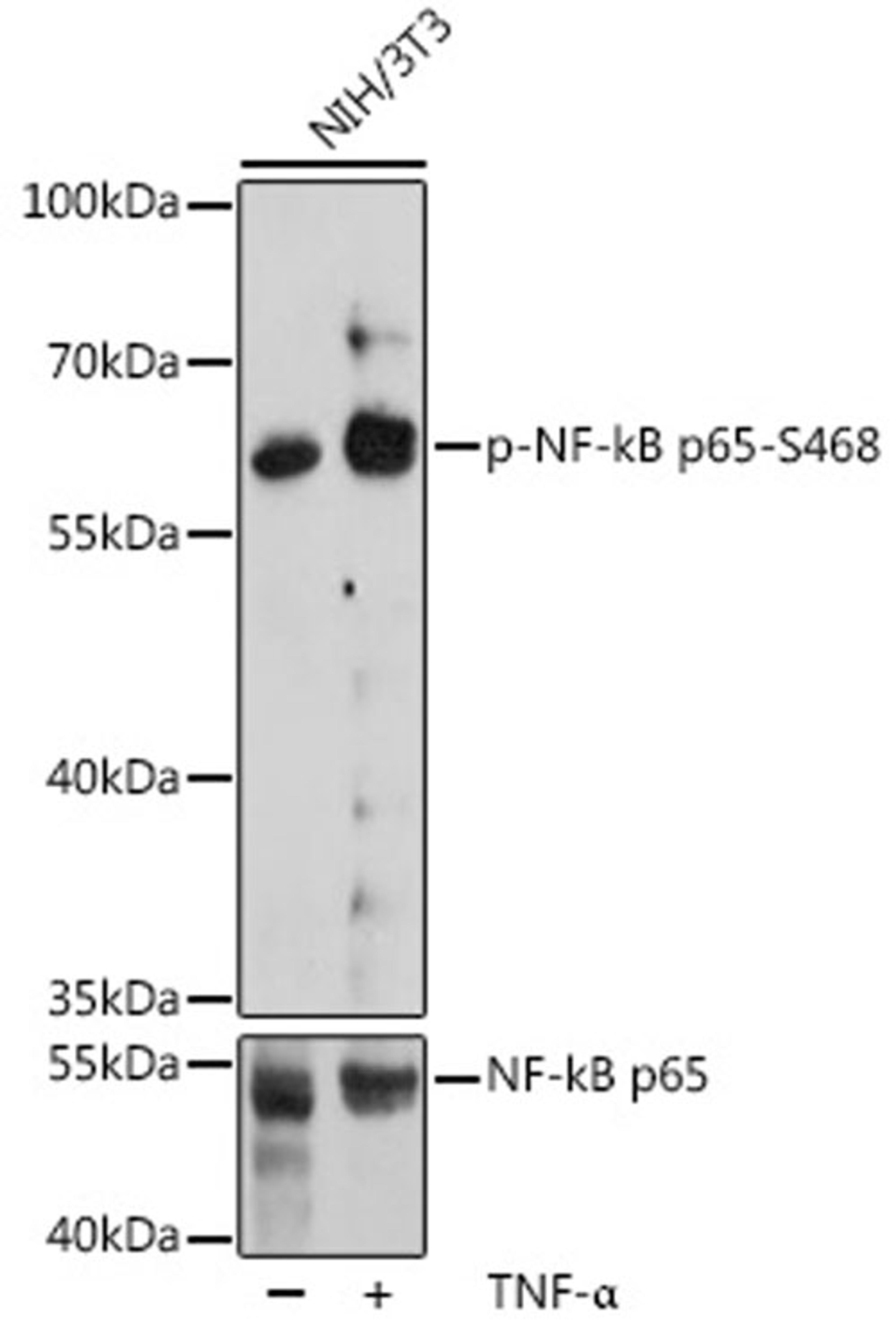 Western blot - Phospho-NF-kB p65-S468 pAb (AP0446)