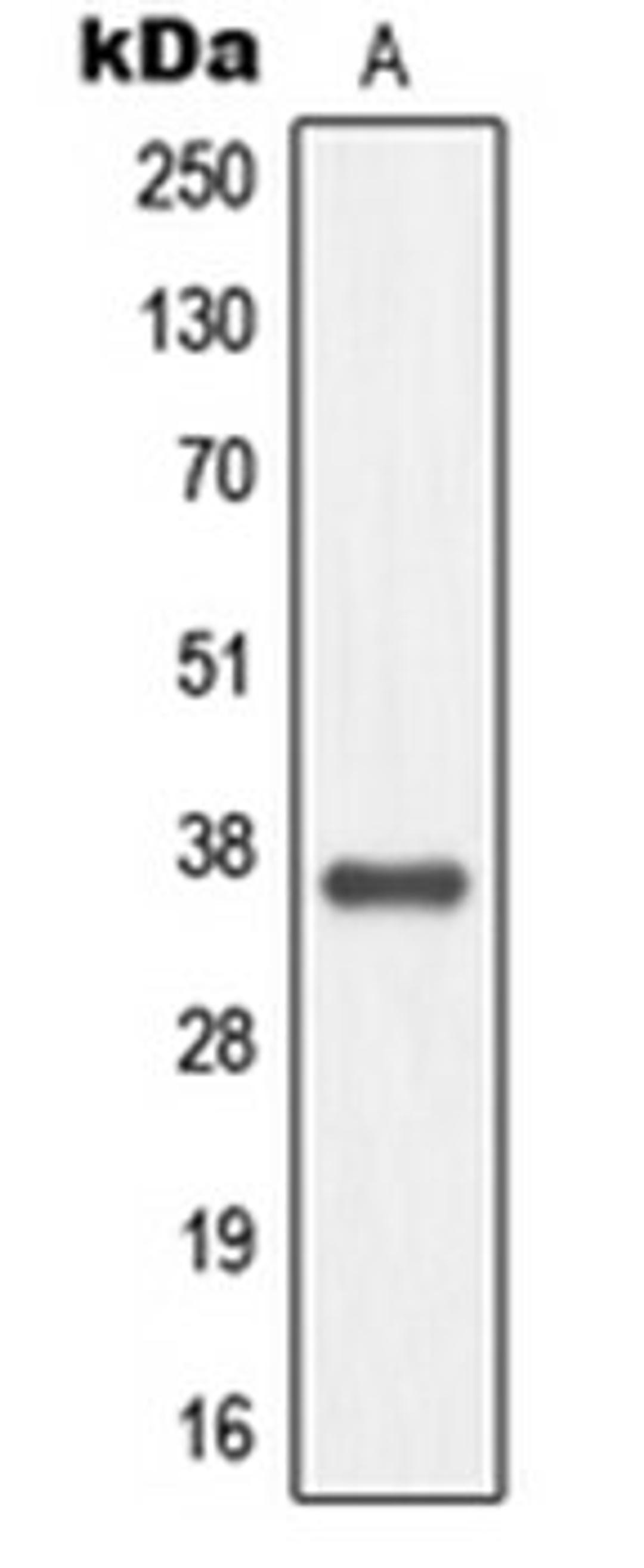 Western blot analysis of EOC20 (Lane 1) whole cell lysates using MC4R antibody