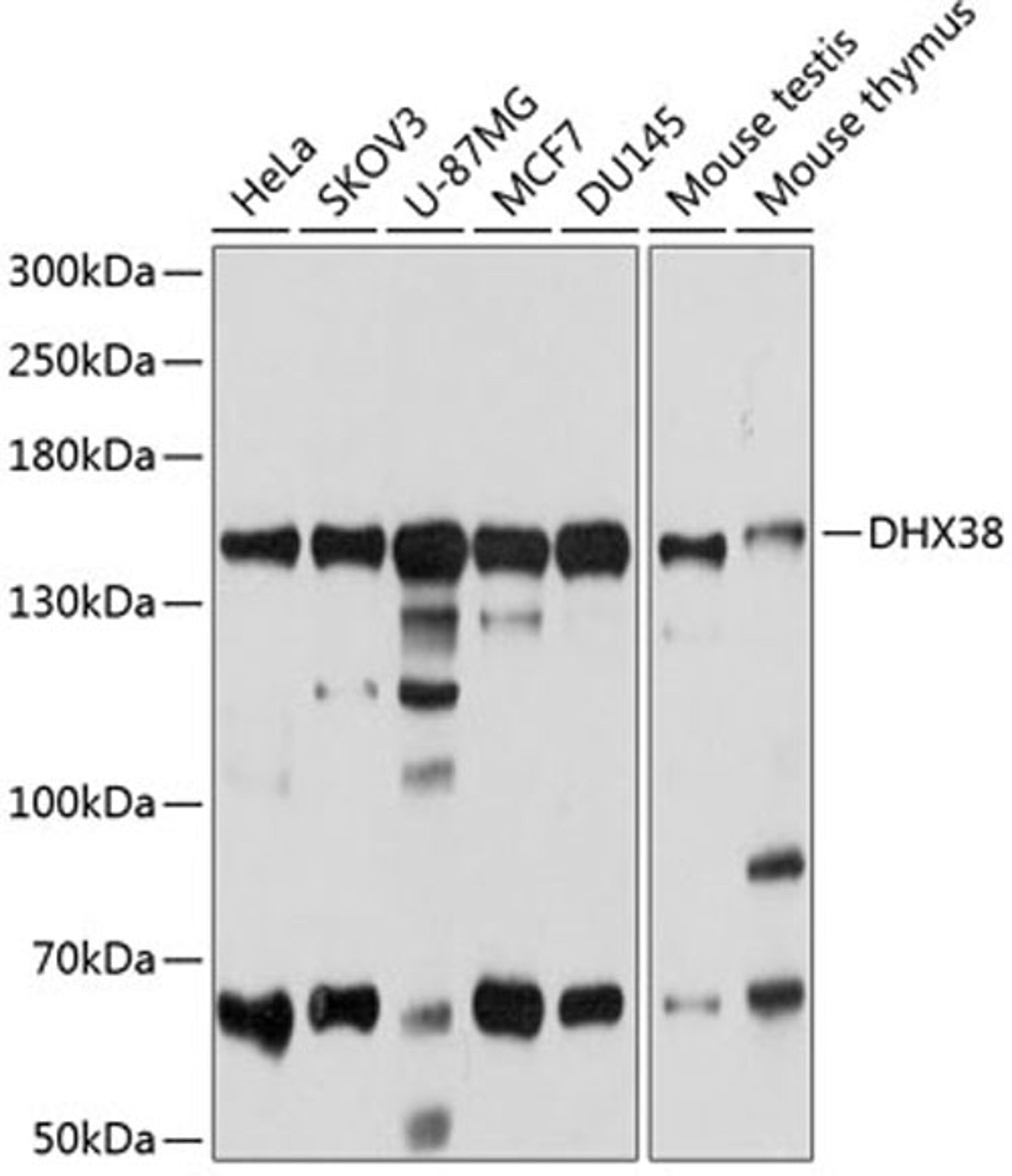 Western blot - DHX38 antibody (A4341)