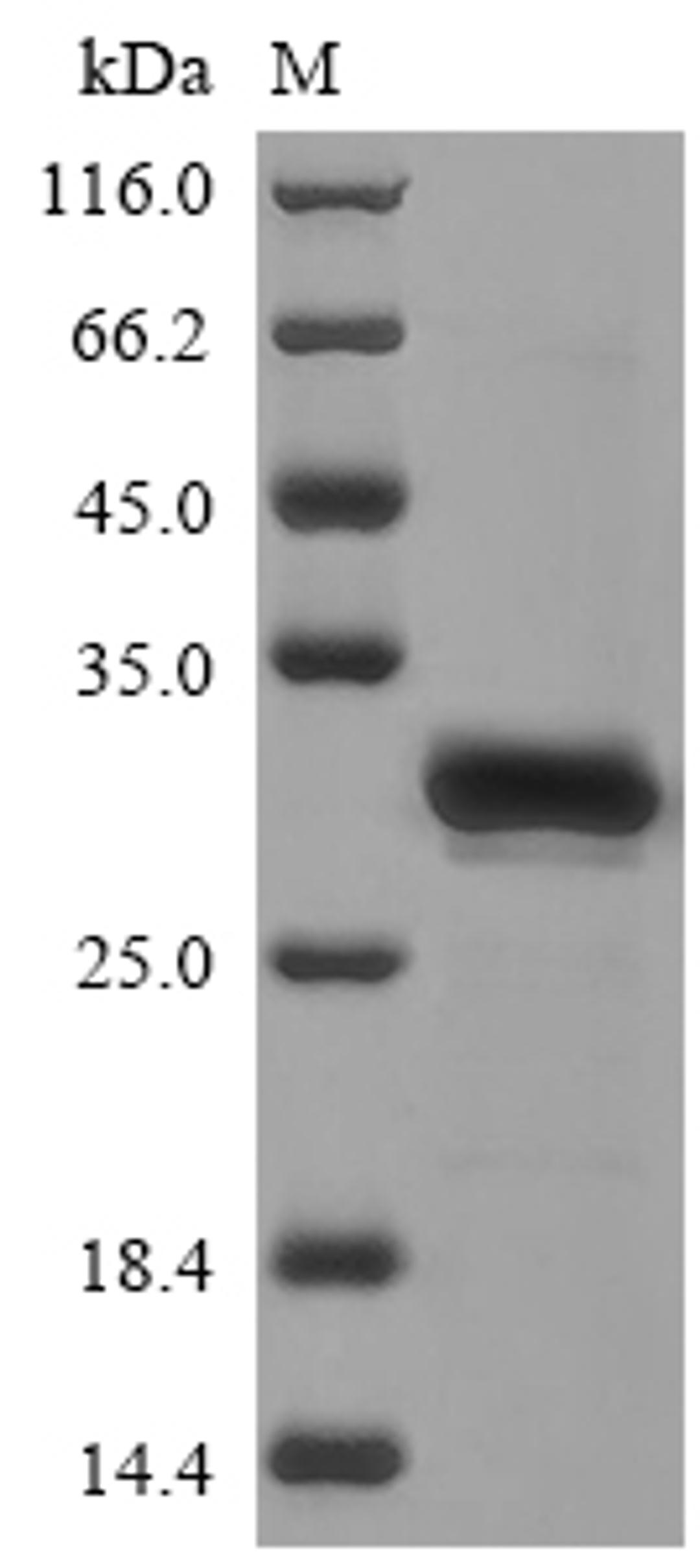 (Tris-Glycine gel) Discontinuous SDS-PAGE (reduced) with 5% enrichment gel and 15% separation gel.
