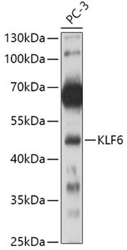 Western blot - KLF6 antibody (A10011)