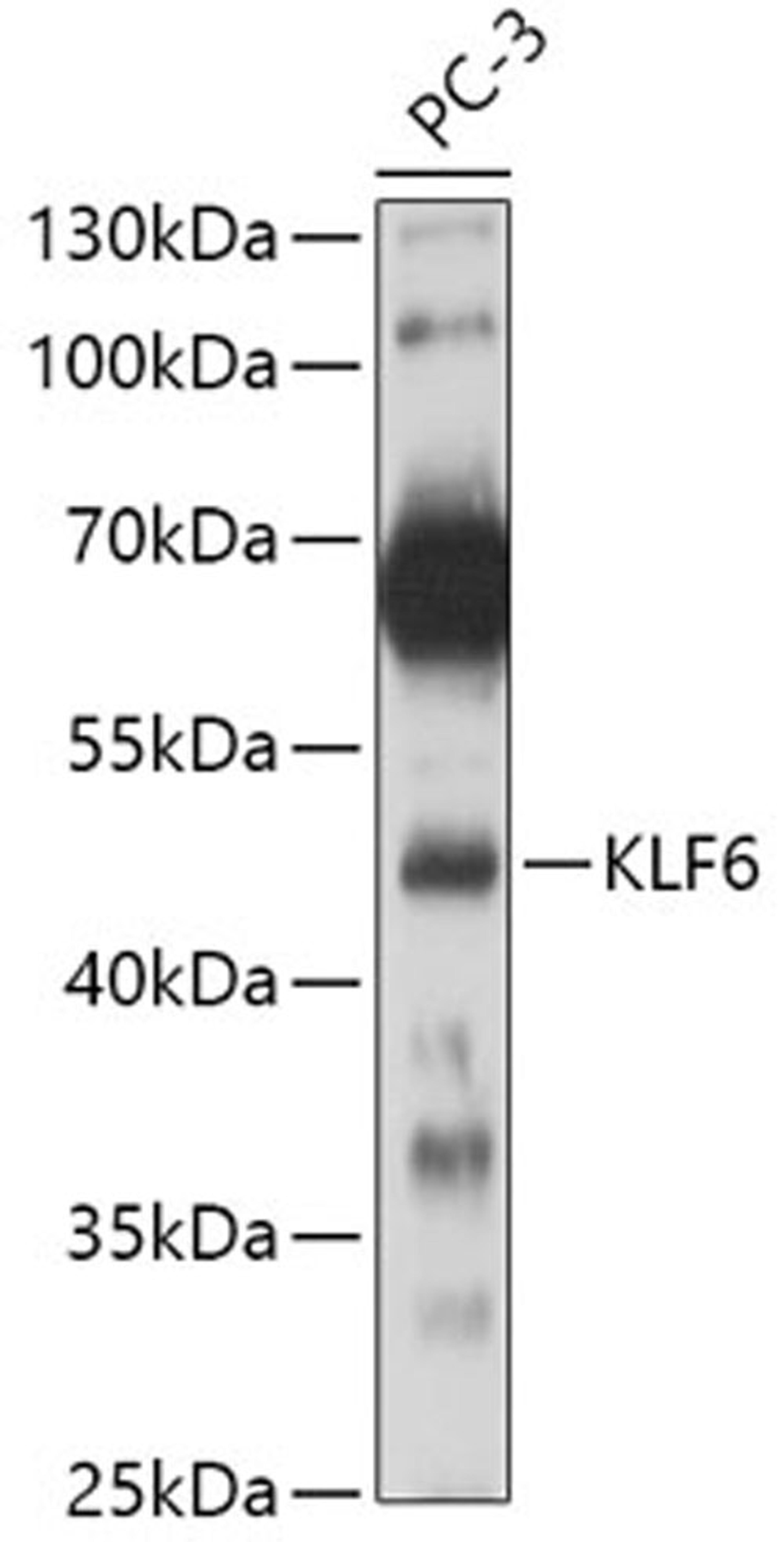 Western blot - KLF6 antibody (A10011)