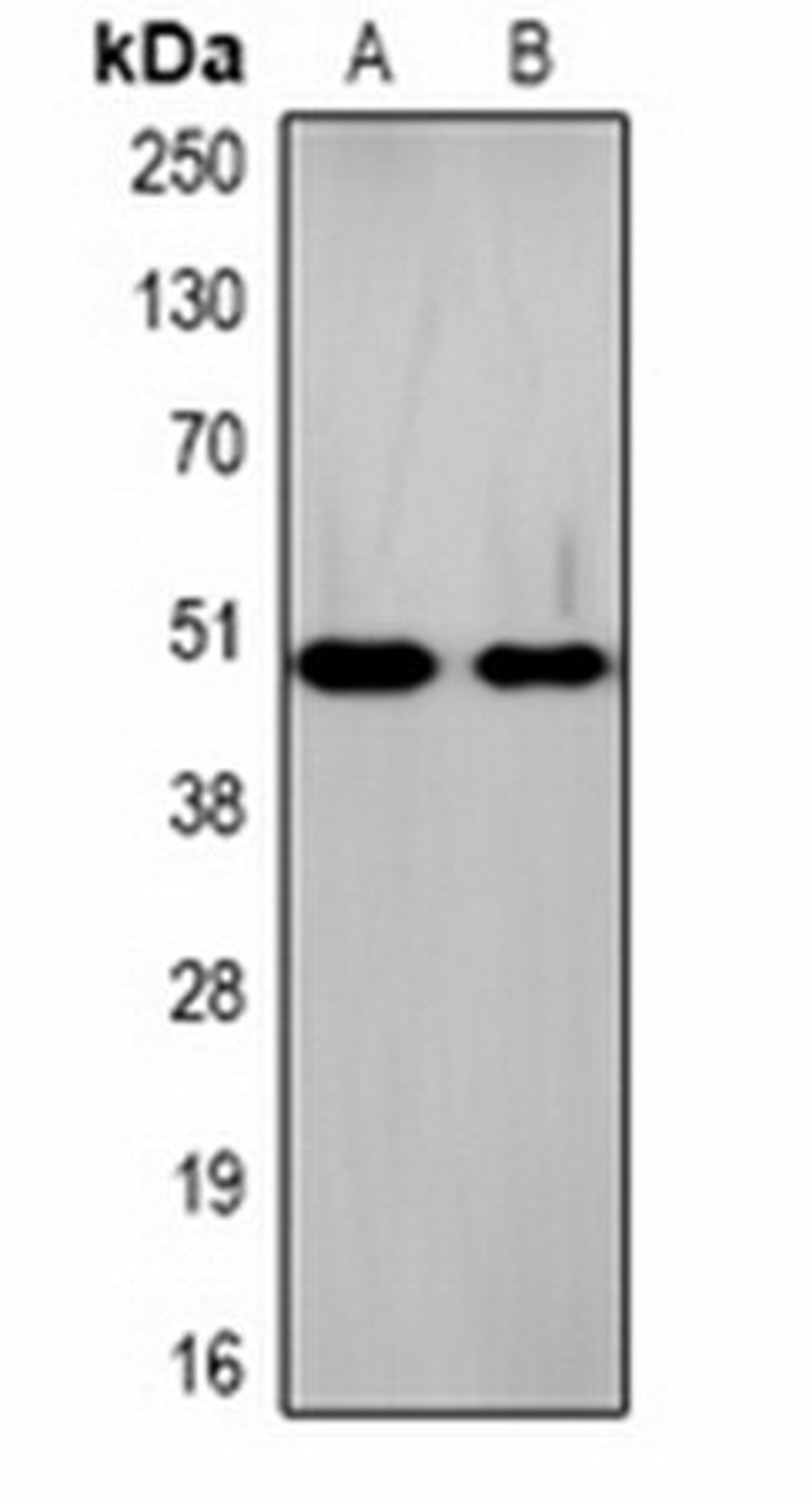 Western blot analysis of  mouse brain (Lane1), rat brain (Lane2) whole cell lysates using Na+/K+-ATPase beta1 antibody