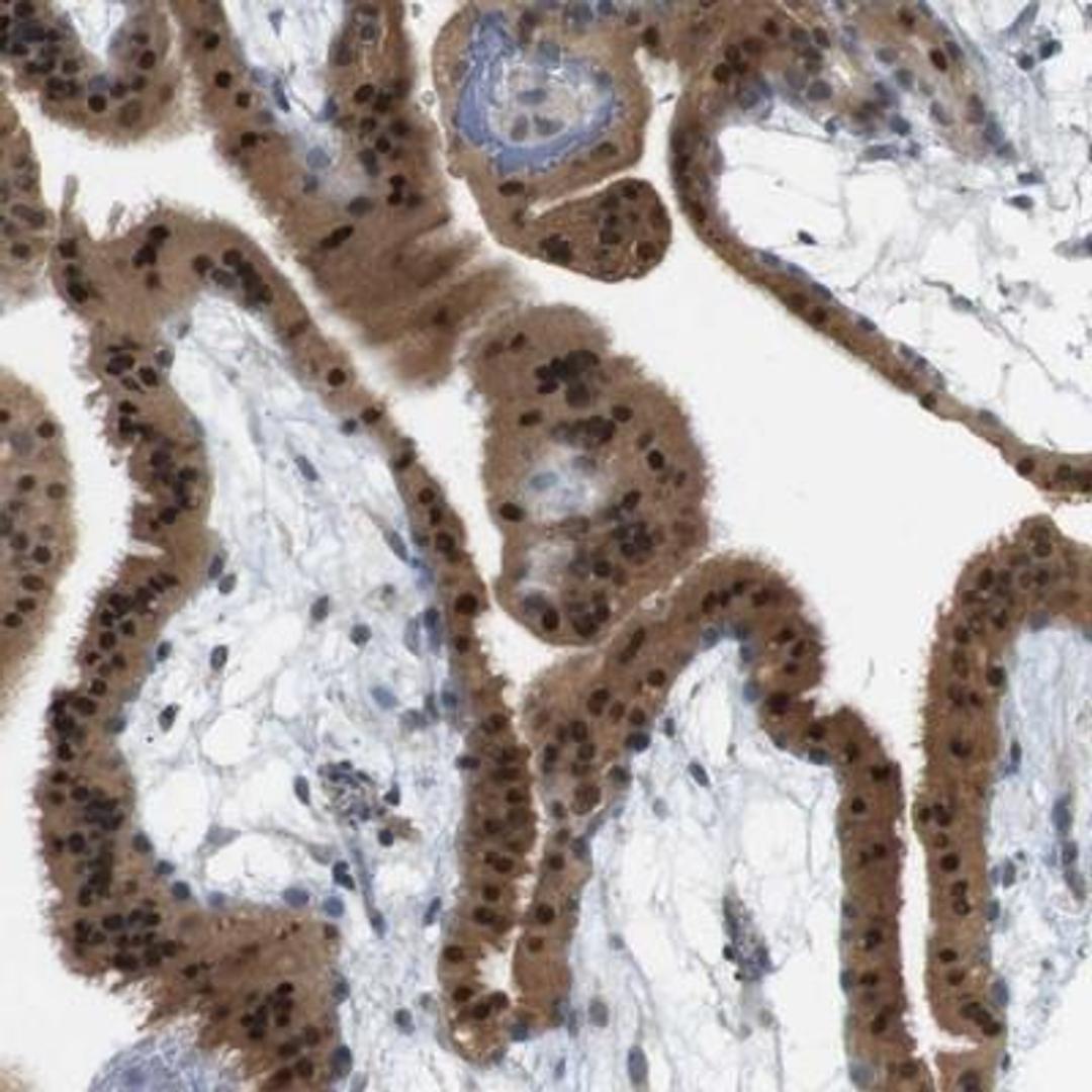 Immunohistochemistry: CREB3L2 Antibody [NBP1-88697] - Staining of human placenta shows strong nuclear and cytoplasmic positivity in trophoblastic cells.