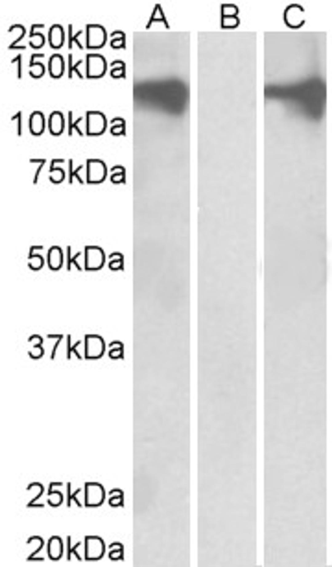 HEK293 lysate (10ug protein in RIPA buffer) overexpressing Human PUM2 with DYKDDDDK tag probed with 46-254 (0.5ug/ml) in Lane A and probed with anti- DYKDDDDK Tag (1/3000) in lane C. Mock-transfected HEK293 probed with 46-254 (1mg/ml) in Lane B. Primary