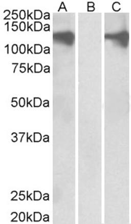 HEK293 lysate (10ug protein in RIPA buffer) overexpressing Human PUM2 with DYKDDDDK tag probed with 46-254 (0.5ug/ml) in Lane A and probed with anti- DYKDDDDK Tag (1/3000) in lane C. Mock-transfected HEK293 probed with 46-254 (1mg/ml) in Lane B. Primary