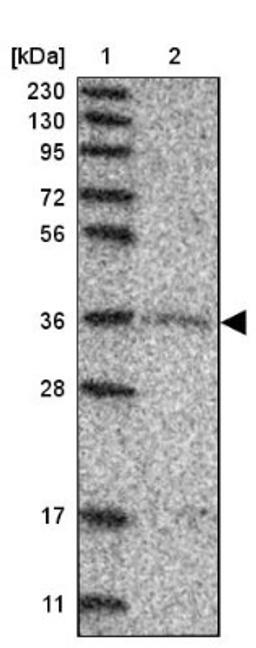 Western Blot: Glycogenin 1 Antibody [NBP1-89723] - Lane 1: Marker [kDa] 230, 130, 95, 72, 56, 36, 28, 17, 11<br/>Lane 2: Human cell line RT-4