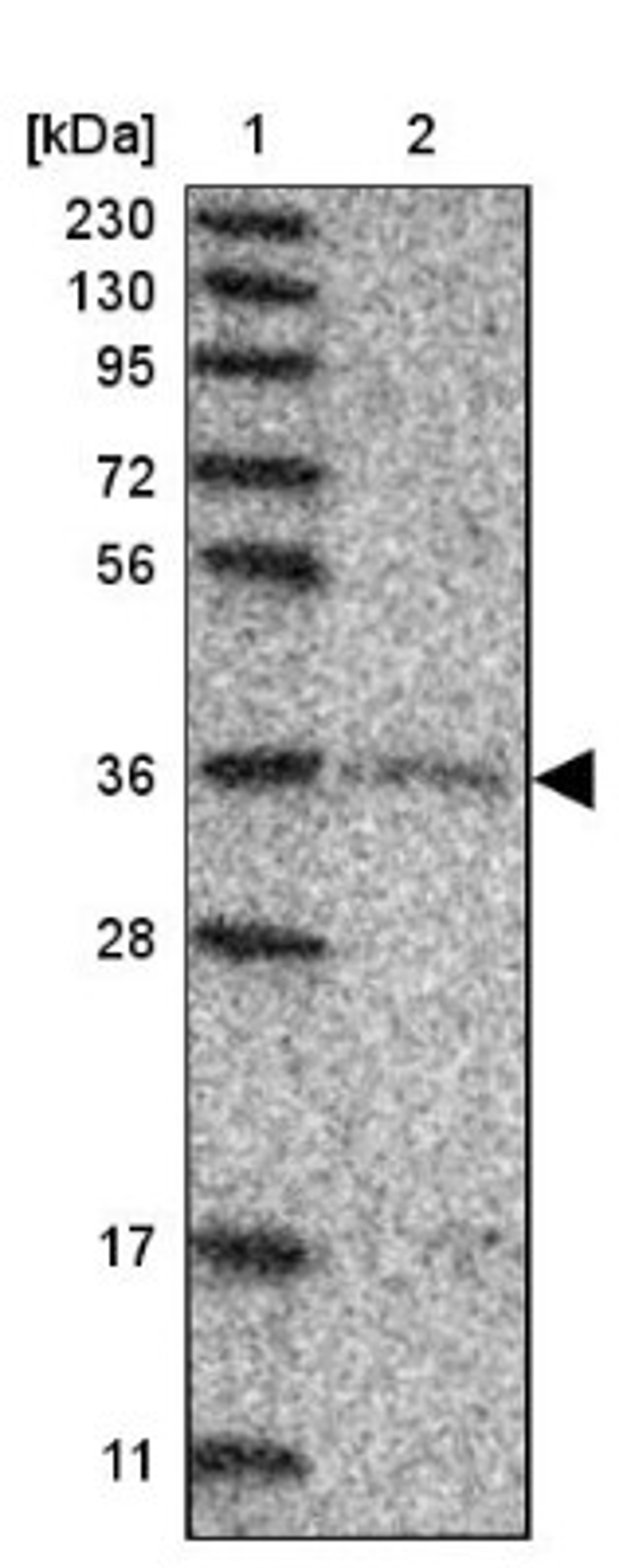 Western Blot: Glycogenin 1 Antibody [NBP1-89723] - Lane 1: Marker [kDa] 230, 130, 95, 72, 56, 36, 28, 17, 11<br/>Lane 2: Human cell line RT-4