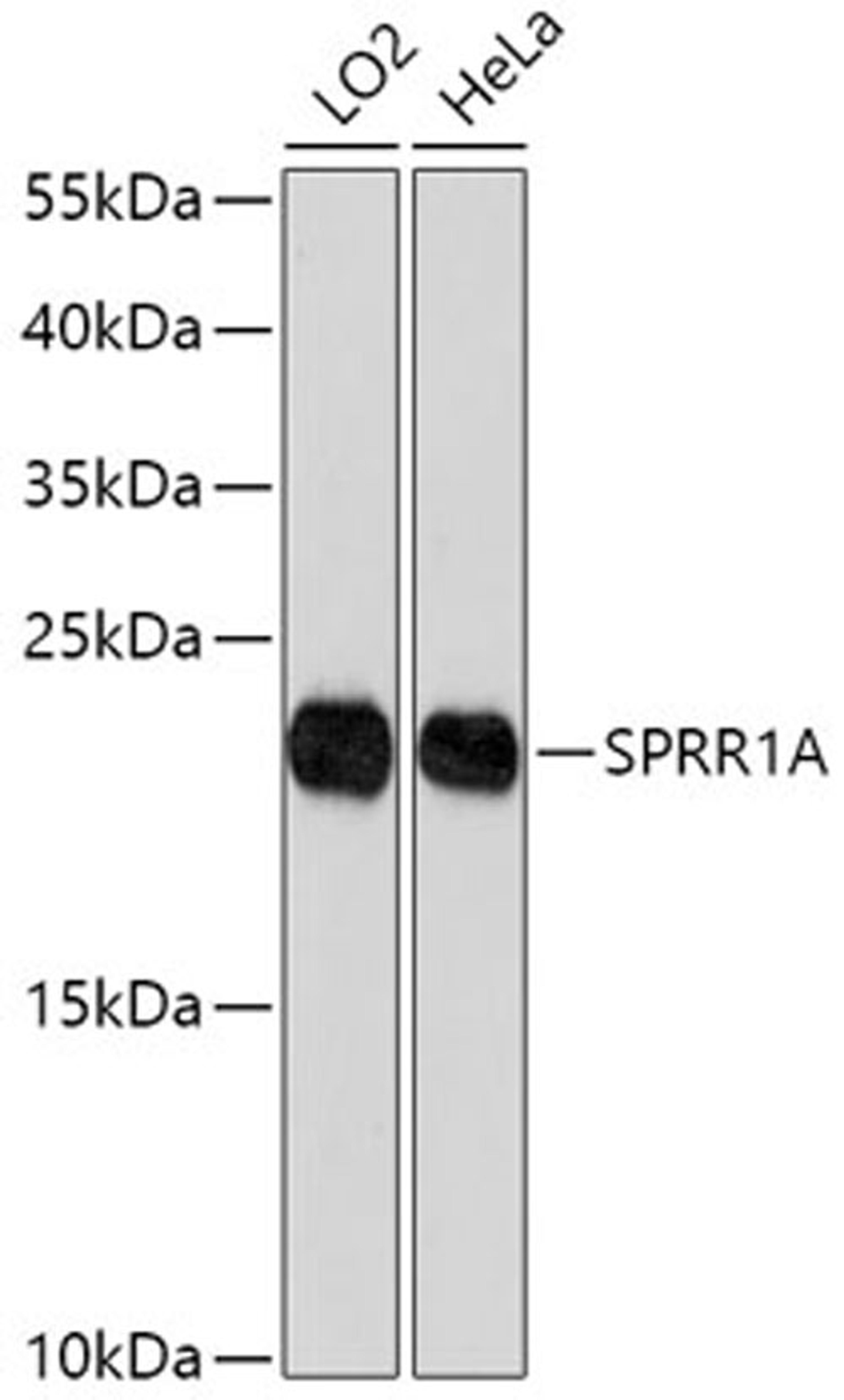 Western blot - SPRR1A antibody (A17535)