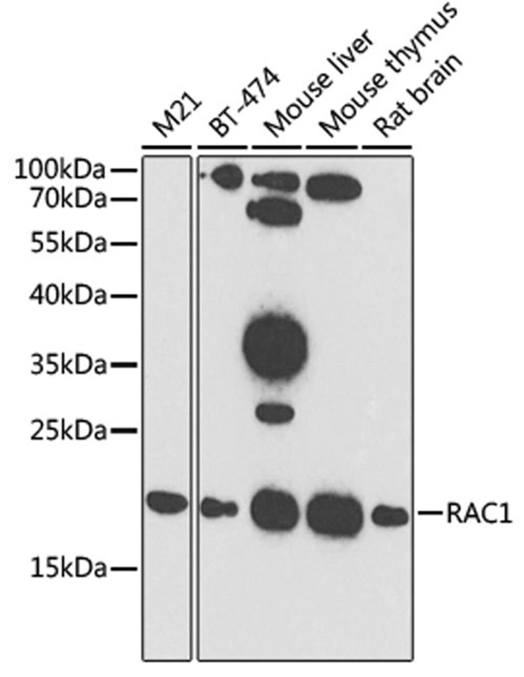 Western blot - RAC1 antibody (A7720)