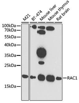 Western blot - RAC1 antibody (A7720)