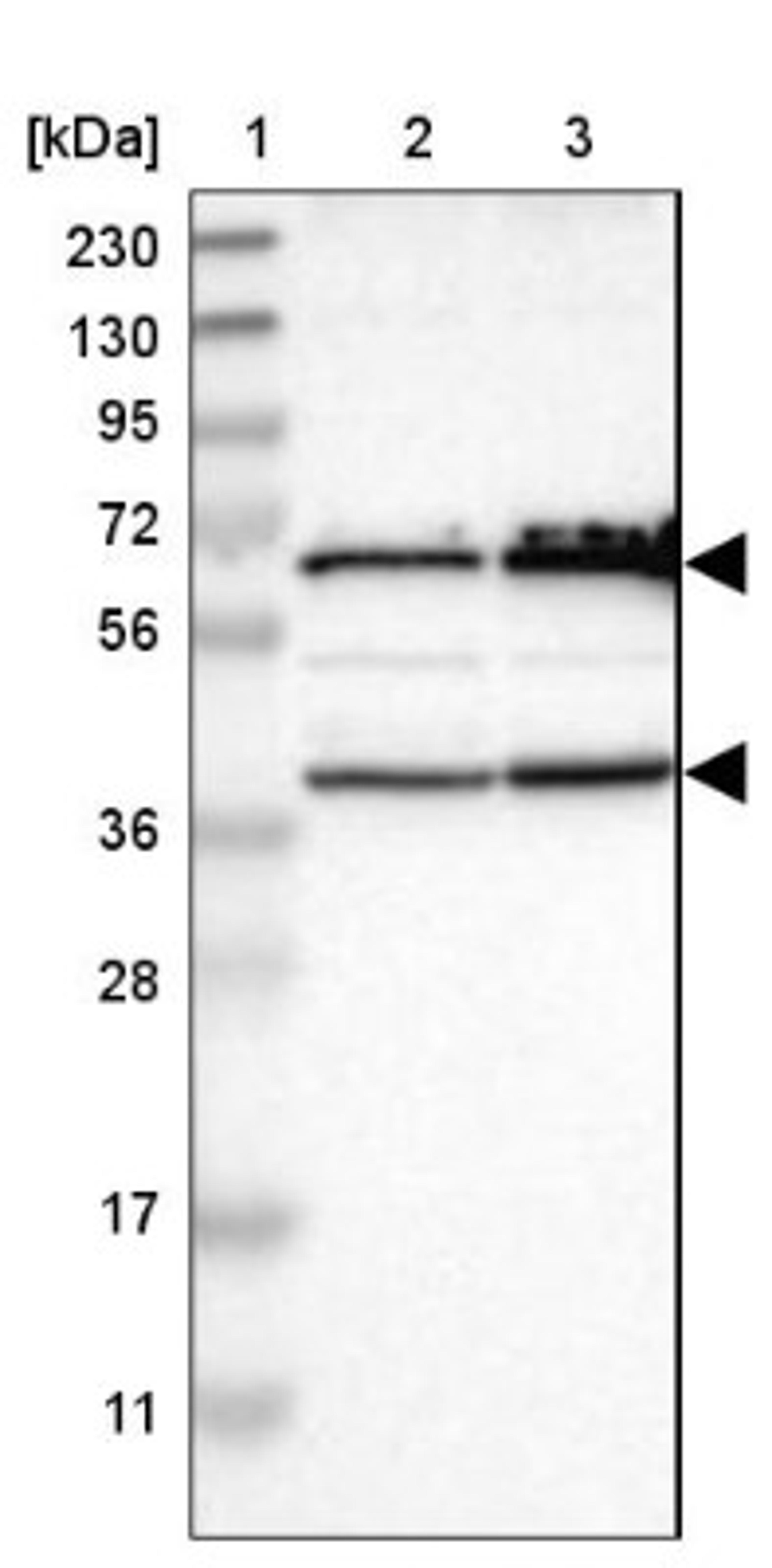 Western Blot: CLCC1 Antibody [NBP1-82792] - Lane 1: Marker [kDa] 230, 130, 95, 72, 56, 36, 28, 17, 11<br/>Lane 2: Human cell line RT-4<br/>Lane 3: Human cell line U-251MG sp