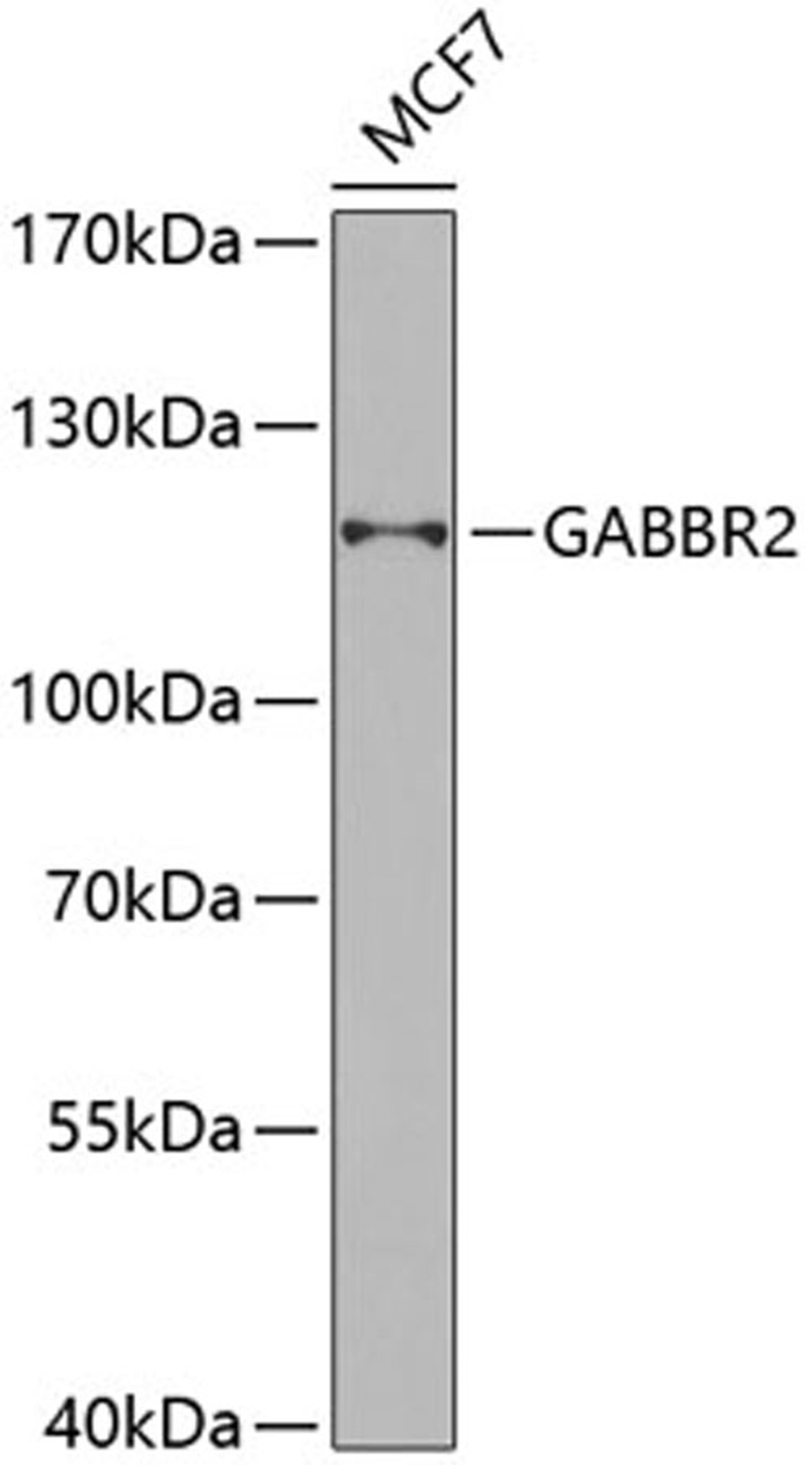 Western blot - GABBR2 antibody (A6594)