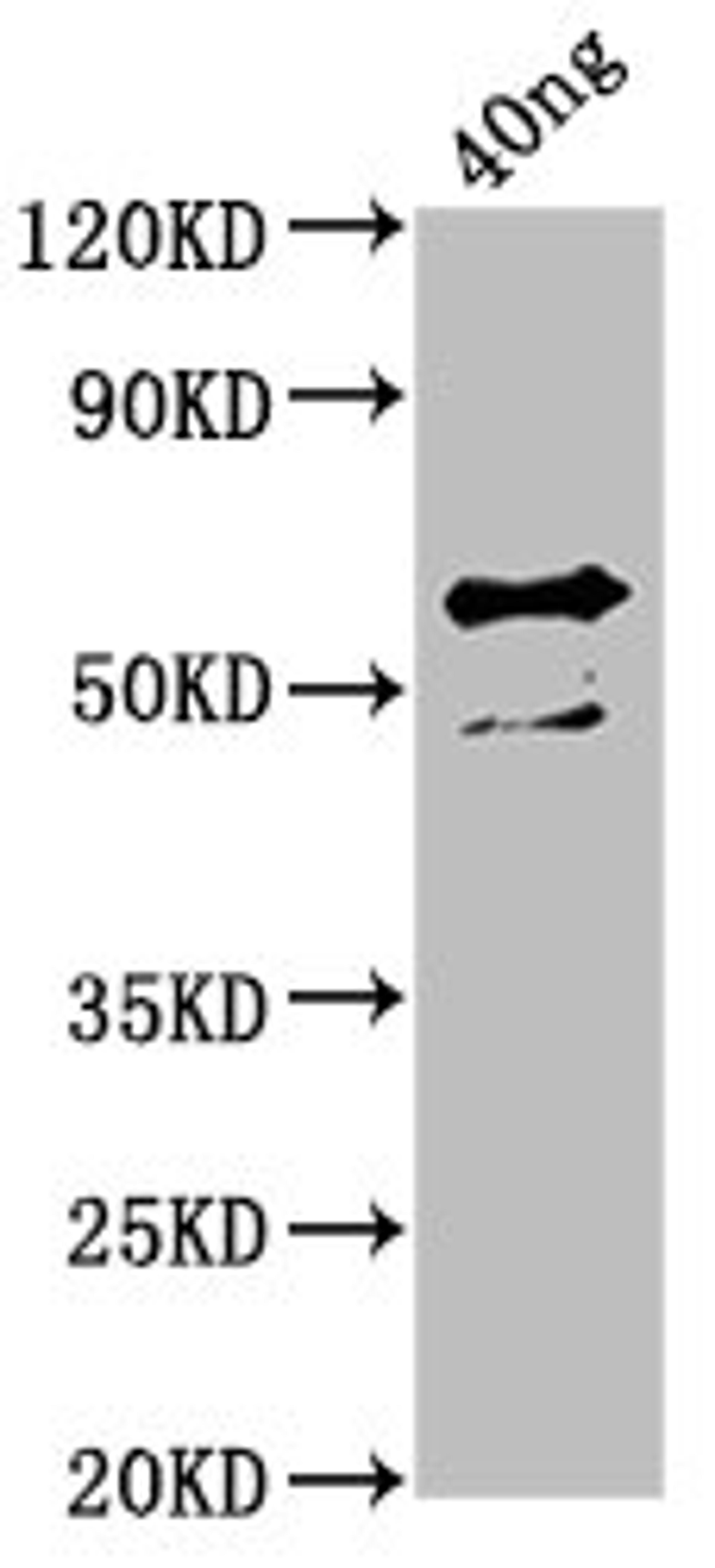 Western Blot. Positive WB detected in Recombinant protein. All lanes: ompA antibody at 4ug/ml. Secondary. Goat polyclonal to rabbit IgG at 1/50000 dilution. Predicted band size: 60 kDa. Observed band size: 60 kDa.