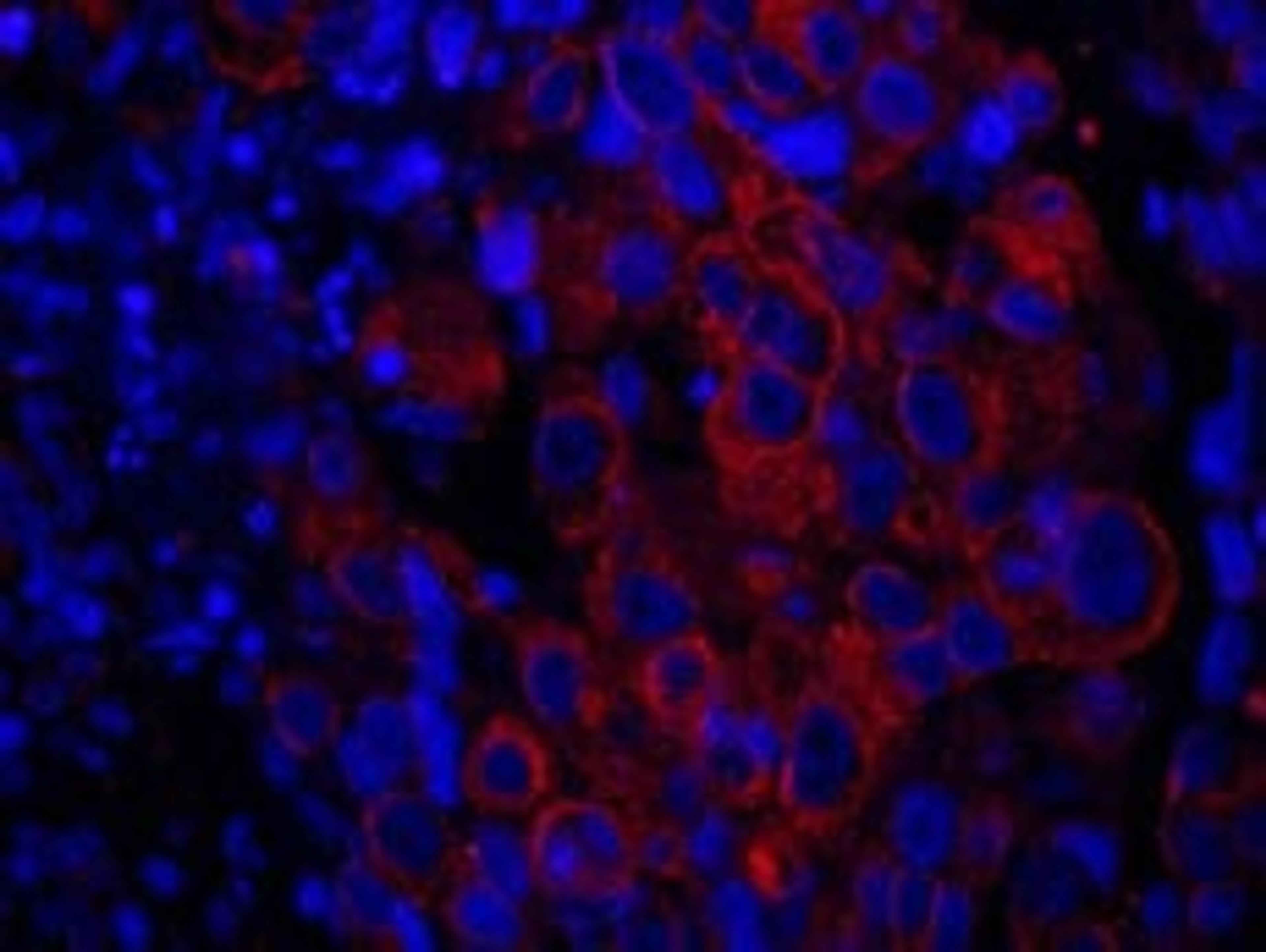 Detection of human SASH1 by immunohistochemistry.