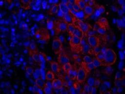 Detection of human SASH1 by immunohistochemistry.