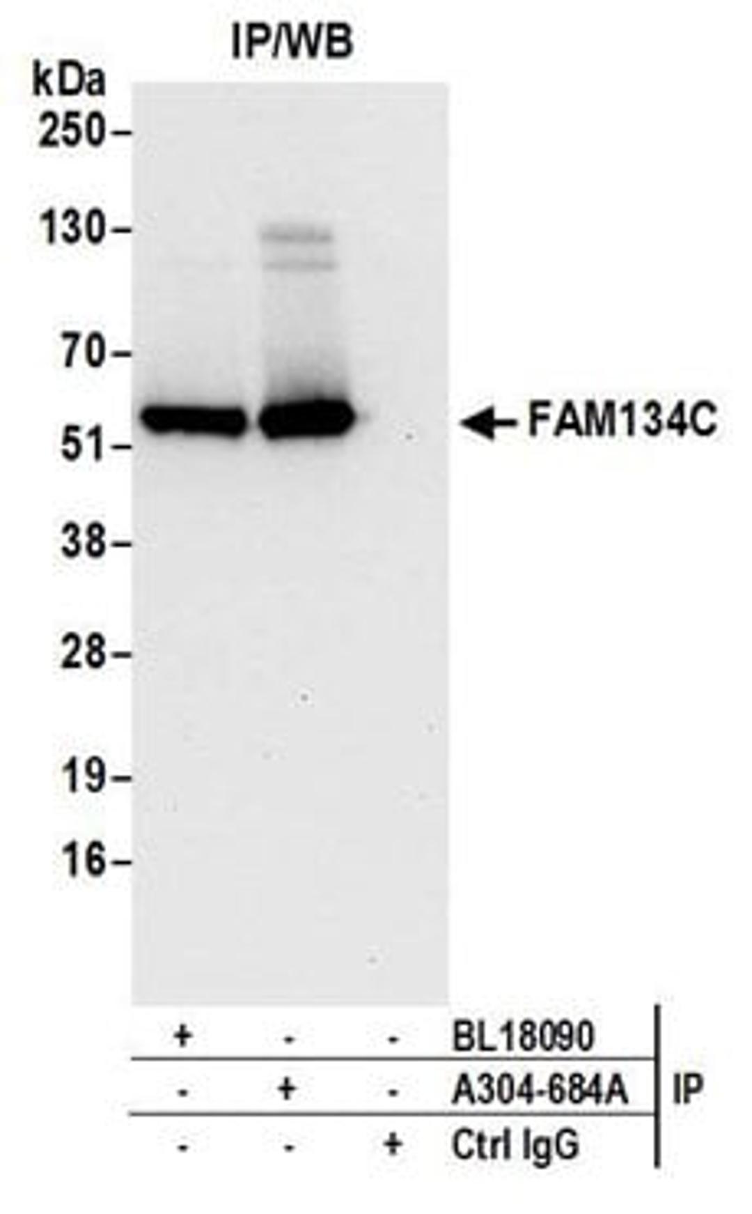 Detection of human FAM134C by western blot of immunoprecipitates.