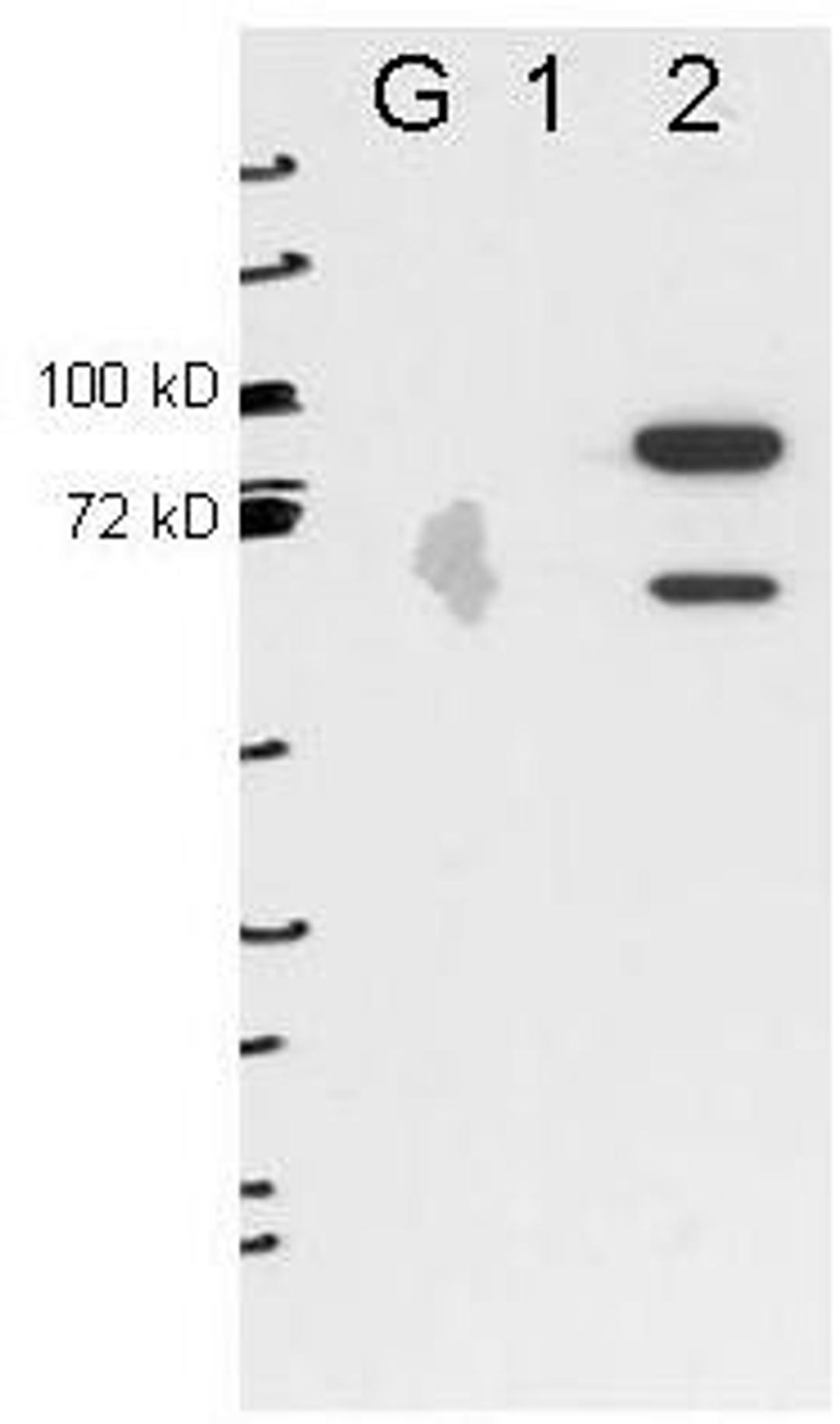 Western blot analysis of 293T cell extracts (lane 2). Lanes G and 1 contain 5ug GFP-transfected- and ESRP1-transfected 293T cell lysates using Esrp-2 antibody