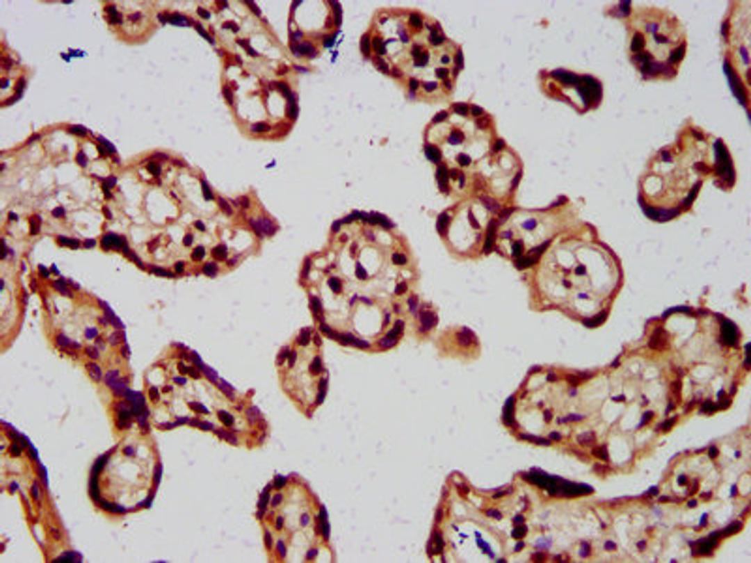 IHC image of CSB-PA010429OA77nme1HU diluted at 1:5 and staining in paraffin-embedded human placenta tissue performed on a Leica BondTM system. After dewaxing and hydration, antigen retrieval was mediated by high pressure in a citrate buffer (pH 6.0). Section was blocked with 10% normal goat serum 30min at RT. Then primary antibody (1% BSA) was incubated at 4&deg;C overnight. The primary is detected by a biotinylated secondary antibody and visualized using an HRP conjugated SP system.