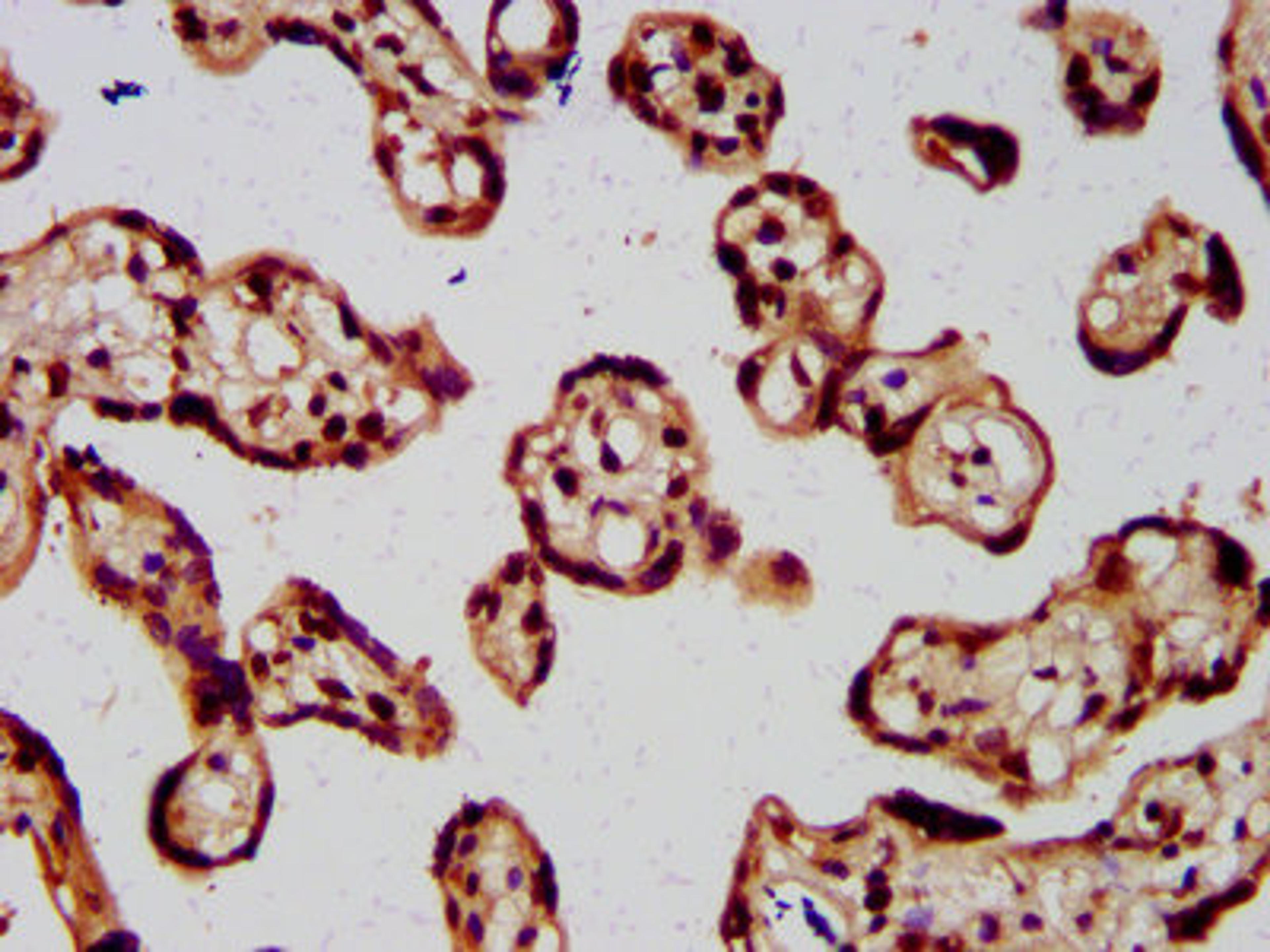 IHC image of CSB-PA010429OA77nme1HU diluted at 1:5 and staining in paraffin-embedded human placenta tissue performed on a Leica BondTM system. After dewaxing and hydration, antigen retrieval was mediated by high pressure in a citrate buffer (pH 6.0). Section was blocked with 10% normal goat serum 30min at RT. Then primary antibody (1% BSA) was incubated at 4&deg;C overnight. The primary is detected by a biotinylated secondary antibody and visualized using an HRP conjugated SP system.