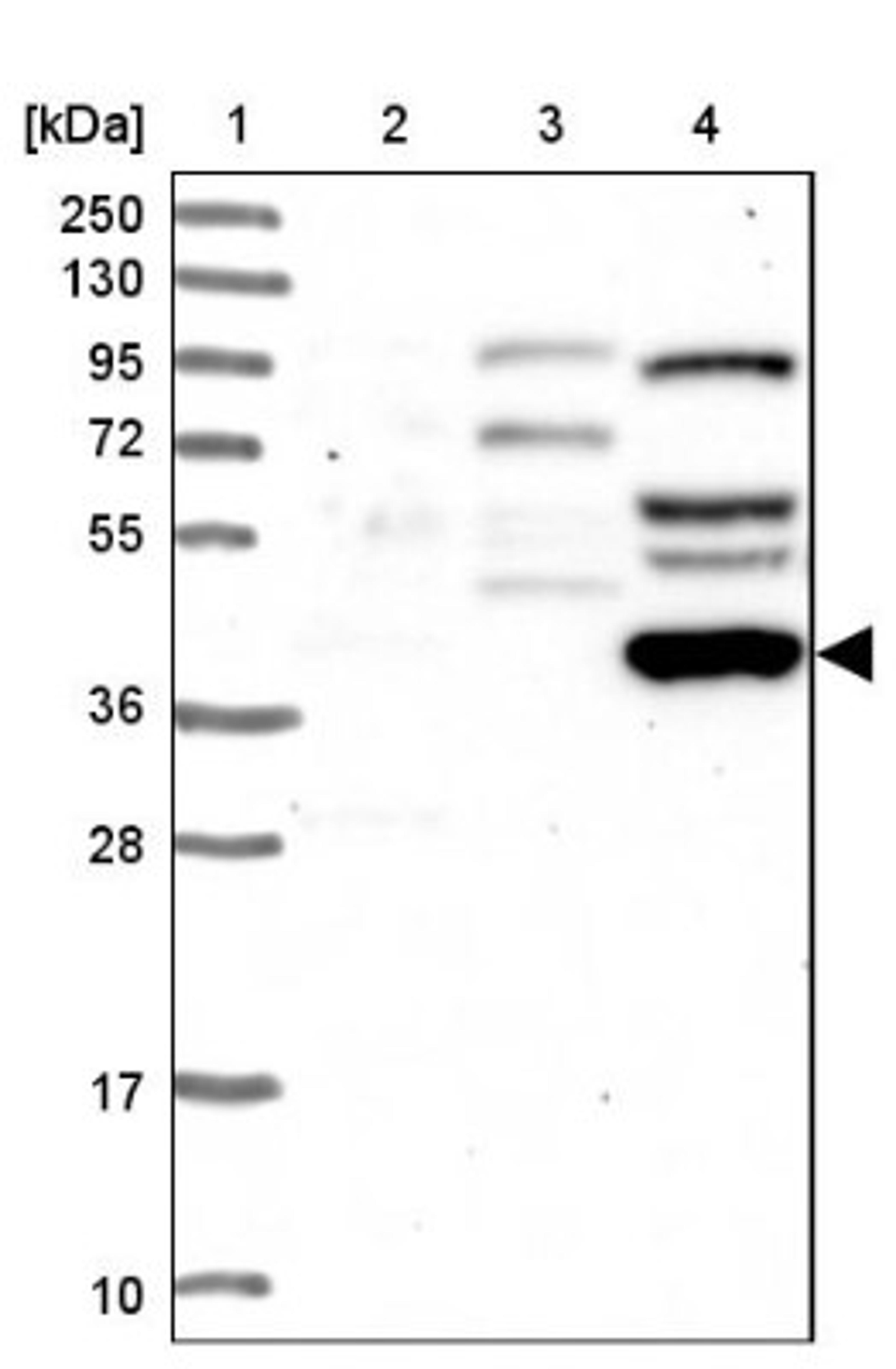 Western Blot: GLT1D1 Antibody [NBP1-82011] - Lane 1: Marker [kDa] 250, 130, 95, 72, 55, 36, 28, 17, 10<br/>Lane 2: Human cell line RT-4<br/>Lane 3: Human cell line U-251MG sp<br/>Lane 4: Human plasma (IgG/HSA depleted)