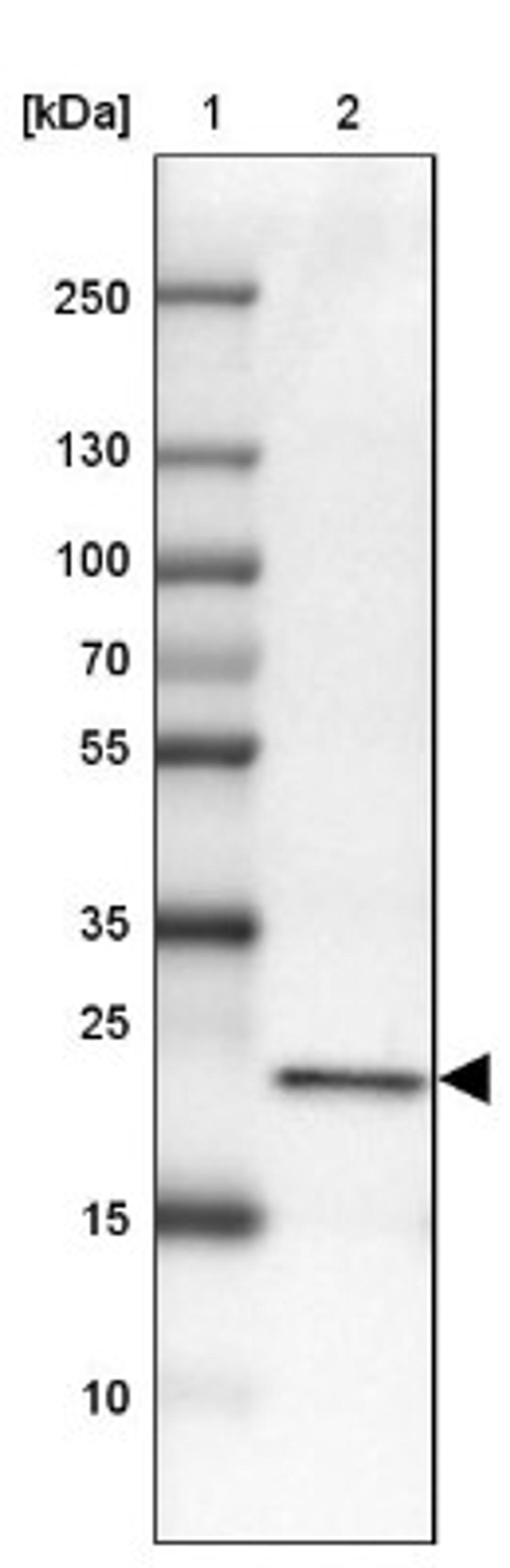 Western Blot: C17orf62 Antibody [NBP2-14553] - Lane 1: Marker [kDa] 250, 130, 100, 70, 55, 35, 25, 15, 10<br/>Lane 2: Liver