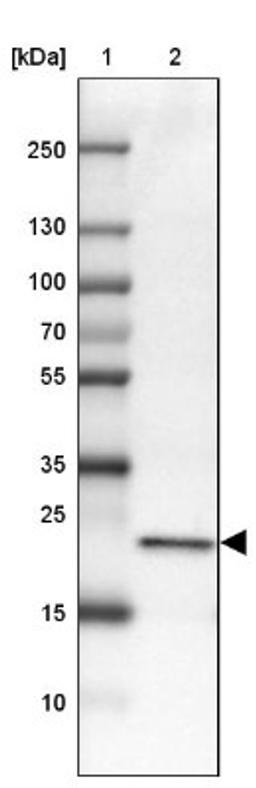 Western Blot: C17orf62 Antibody [NBP2-14553] - Lane 1: Marker [kDa] 250, 130, 100, 70, 55, 35, 25, 15, 10<br/>Lane 2: Liver