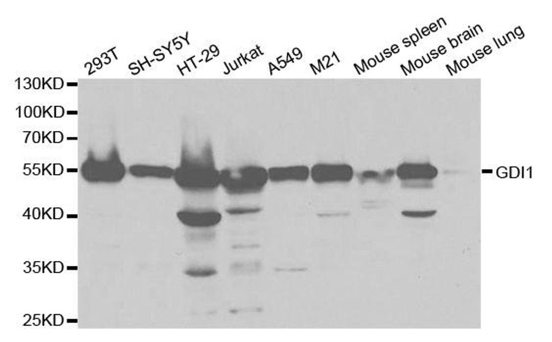 Western blot analysis of extracts of various cell lines using GDI1 antibody