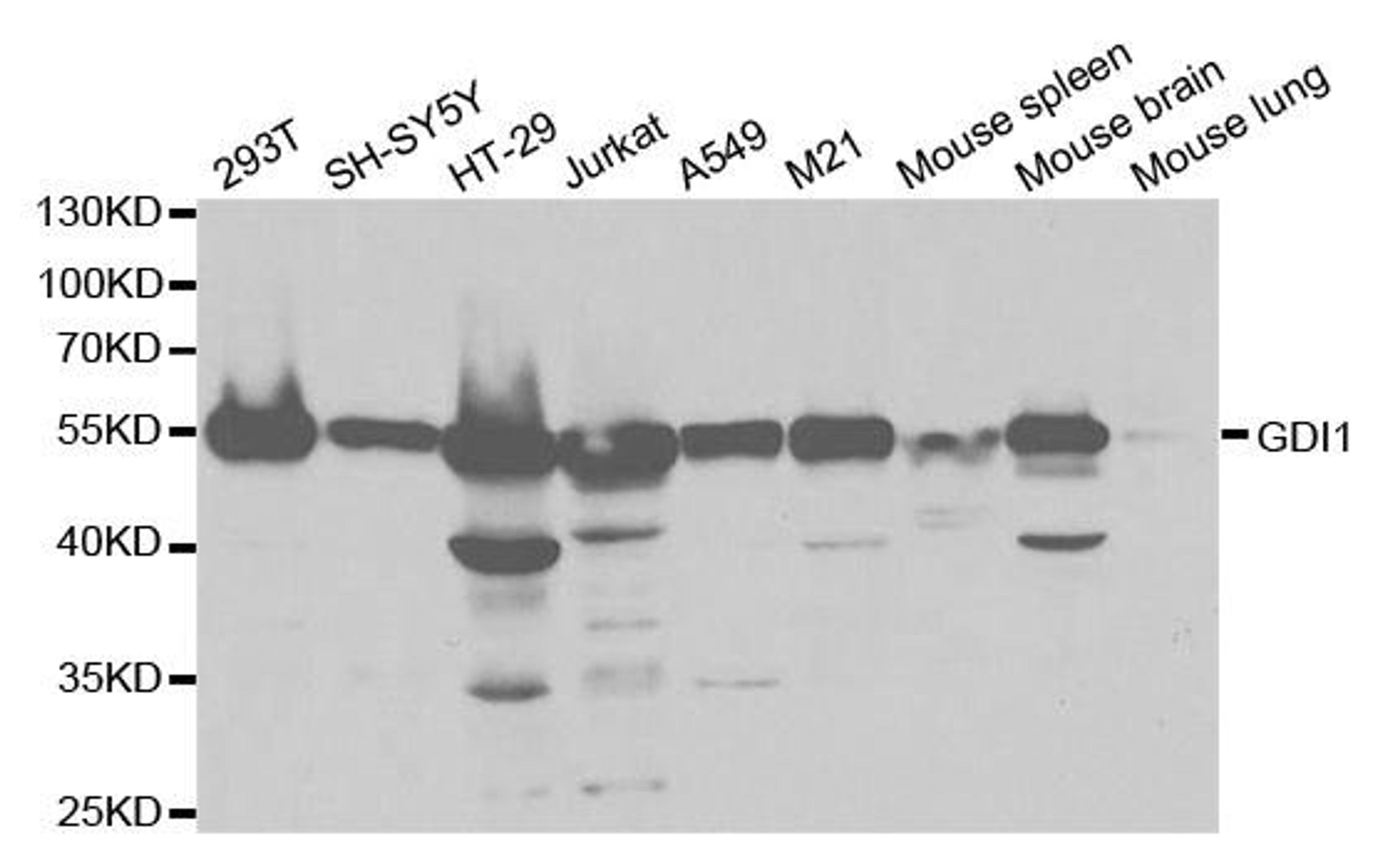 Western blot analysis of extracts of various cell lines using GDI1 antibody