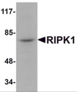 Western blot analysis of RIPK1 in rat kidney tissue lysate with RIPK1 antibody at 1 μg/mL.