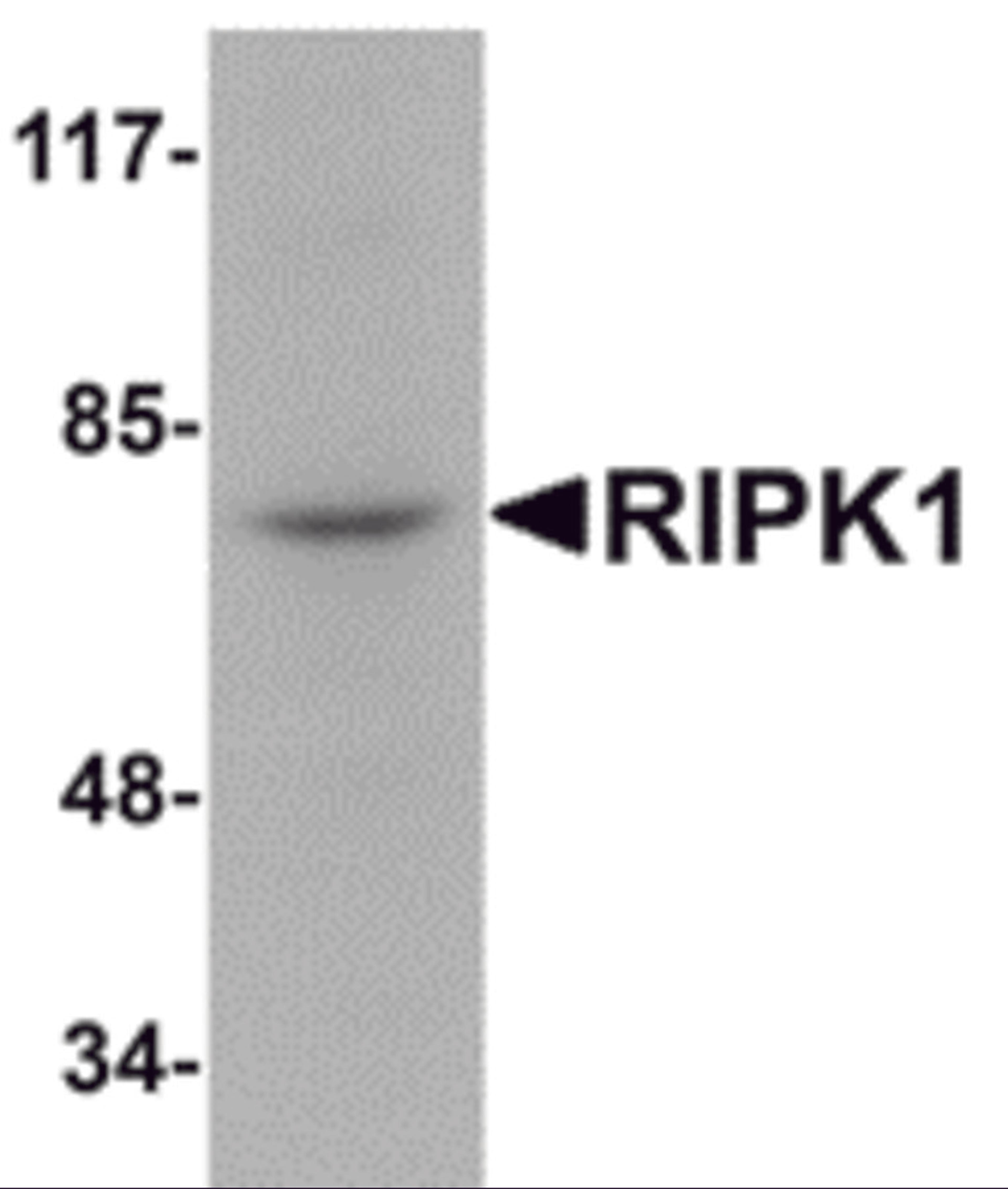 Western blot analysis of RIPK1 in rat kidney tissue lysate with RIPK1 antibody at 1 μg/mL.