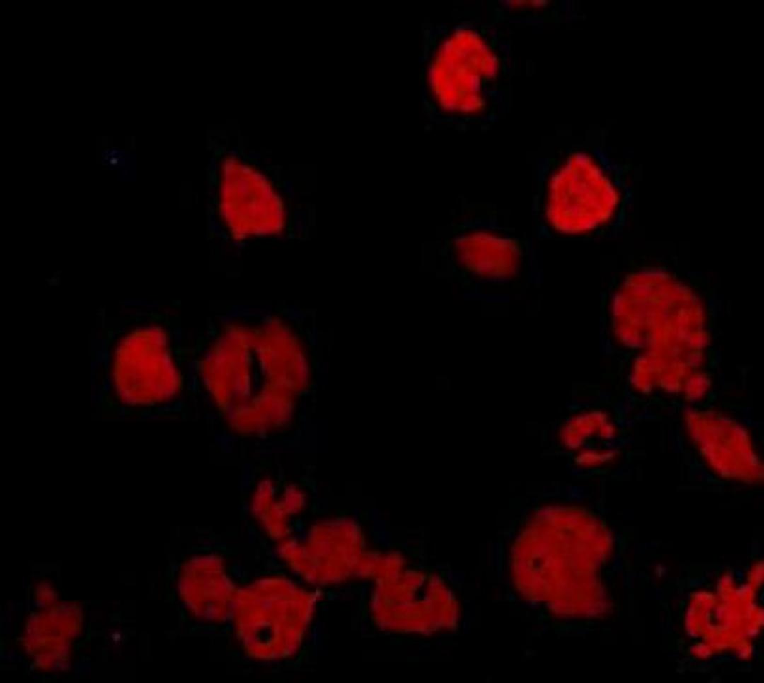 Immunofluorescent staining of Hela cells using Breast cancer-overexpressed gene 1 protein antibody