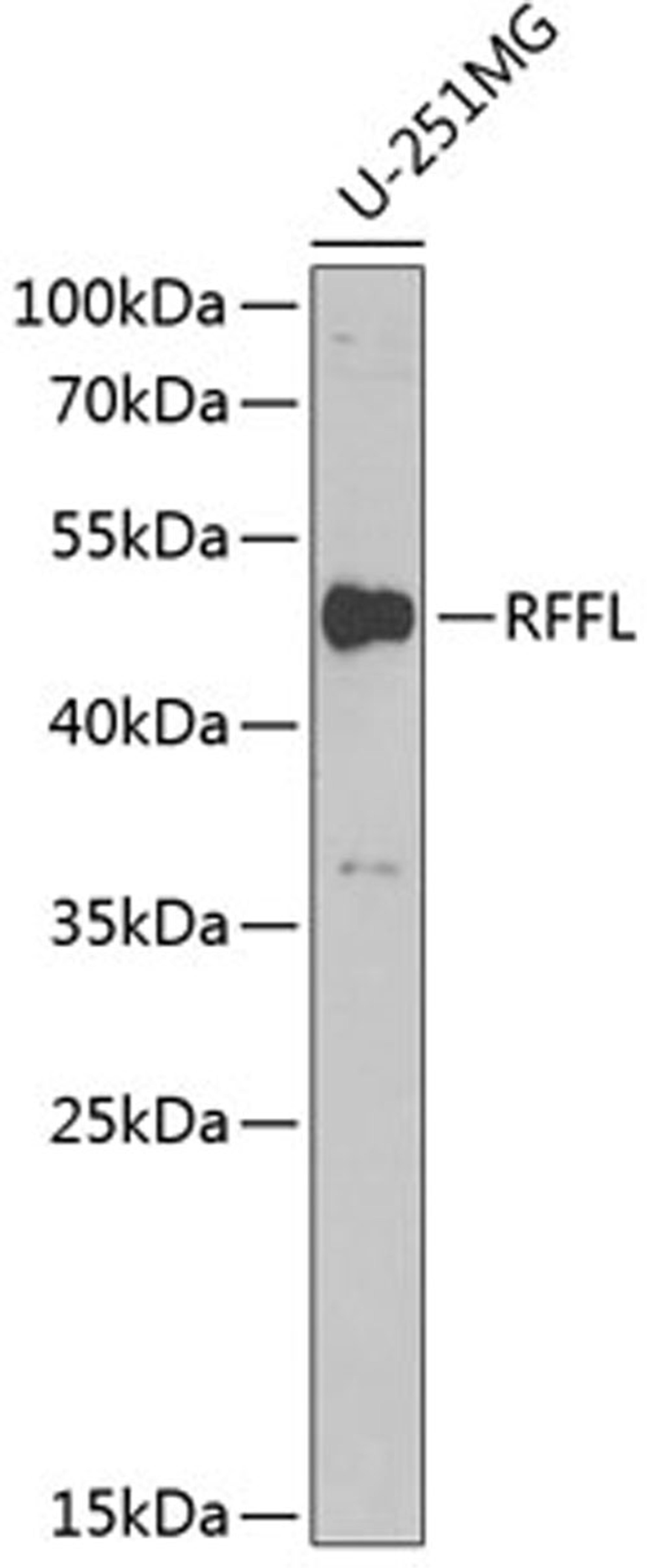 Western blot - RFFL antibody (A6489)