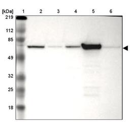 Western Blot: FRMD6 Antibody [NBP1-90725] - Lane 1: Marker [kDa] 219, 112, 85, 49, 32, 25, 18<br/>Lane 2: Human cell line RT-4<br/>Lane 3: Human cell line EFO-21<br/>Lane 4: Human cell line A-431<br/>Lane 5: Human liver tissue<br/>Lane 6: Human tonsil tissue