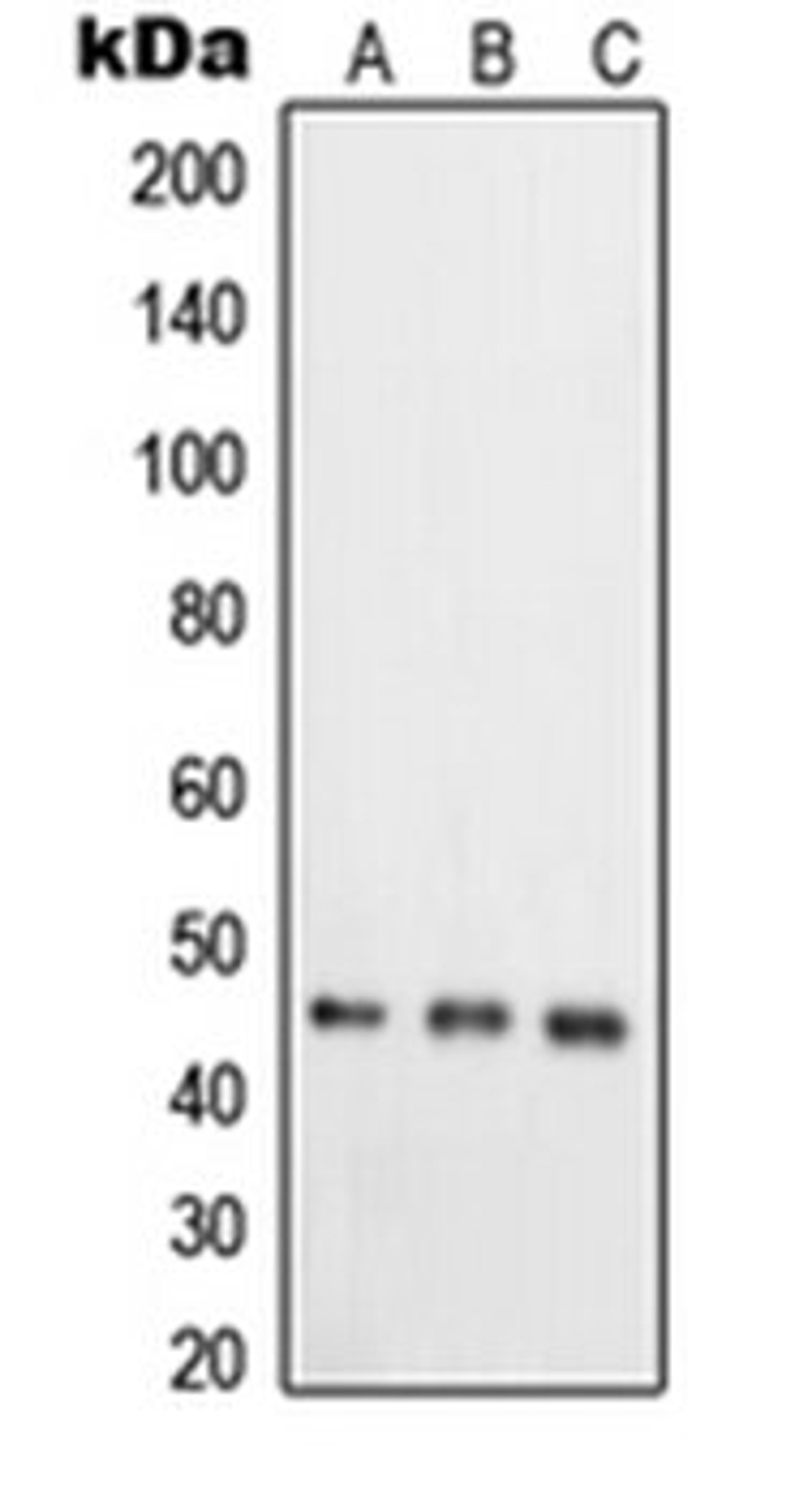 Western blot analysis of HeLa (Lane 1), T47D (Lane 2), COLO205 (Lane 3) whole cell lysates using RELT antibody