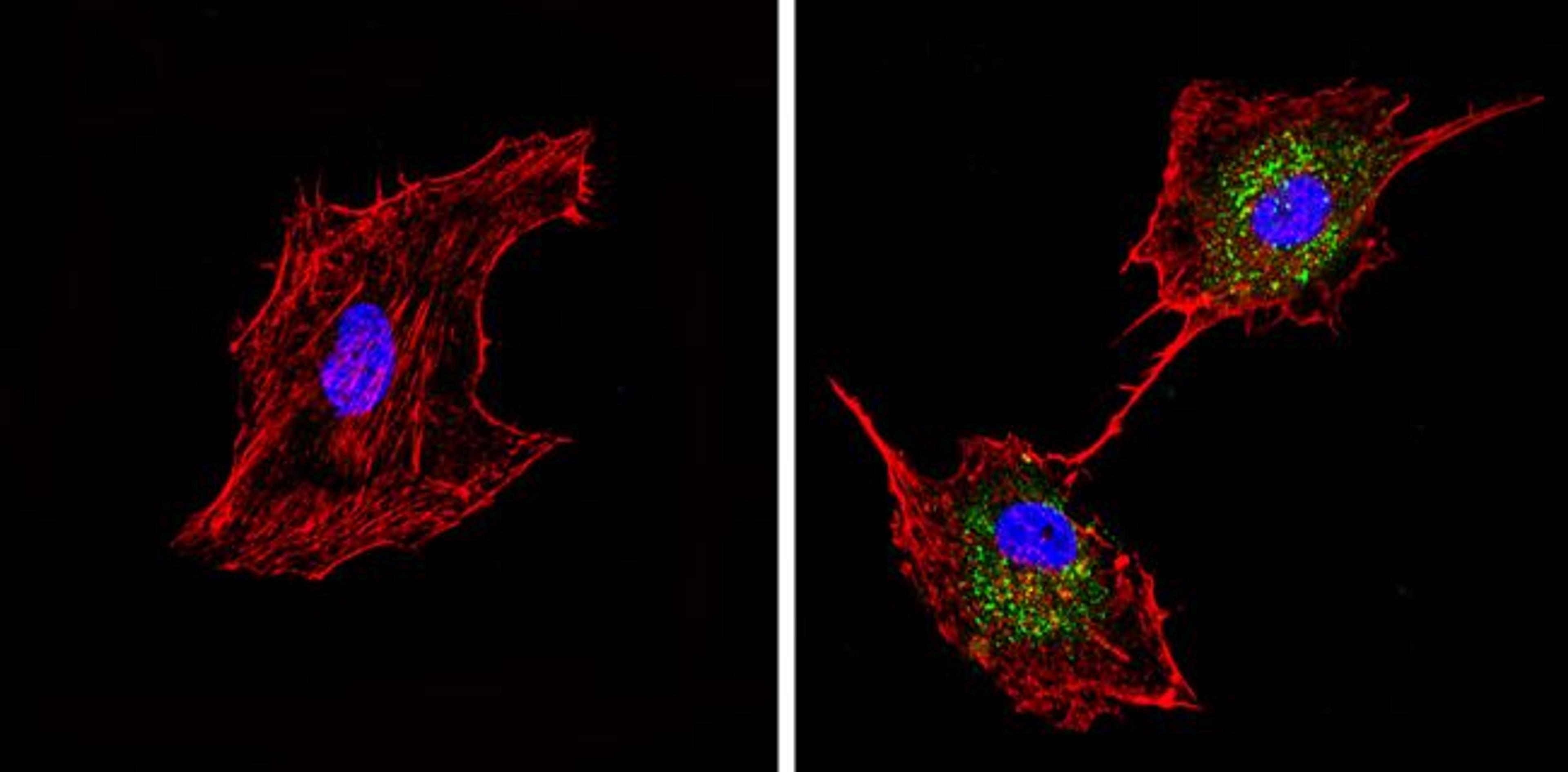 Synaptojanin 1 Antibody (MA3-936) in IF