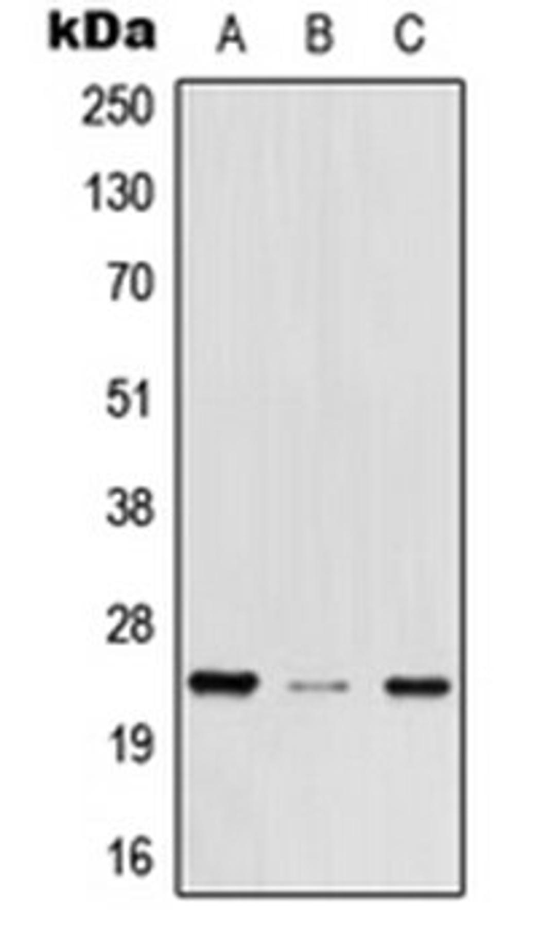 Western blot analysis of HEK293T (Lane 1), mouse brain (Lane 2), rat lung (Lane 3) whole cell lysates using MED29 antibody