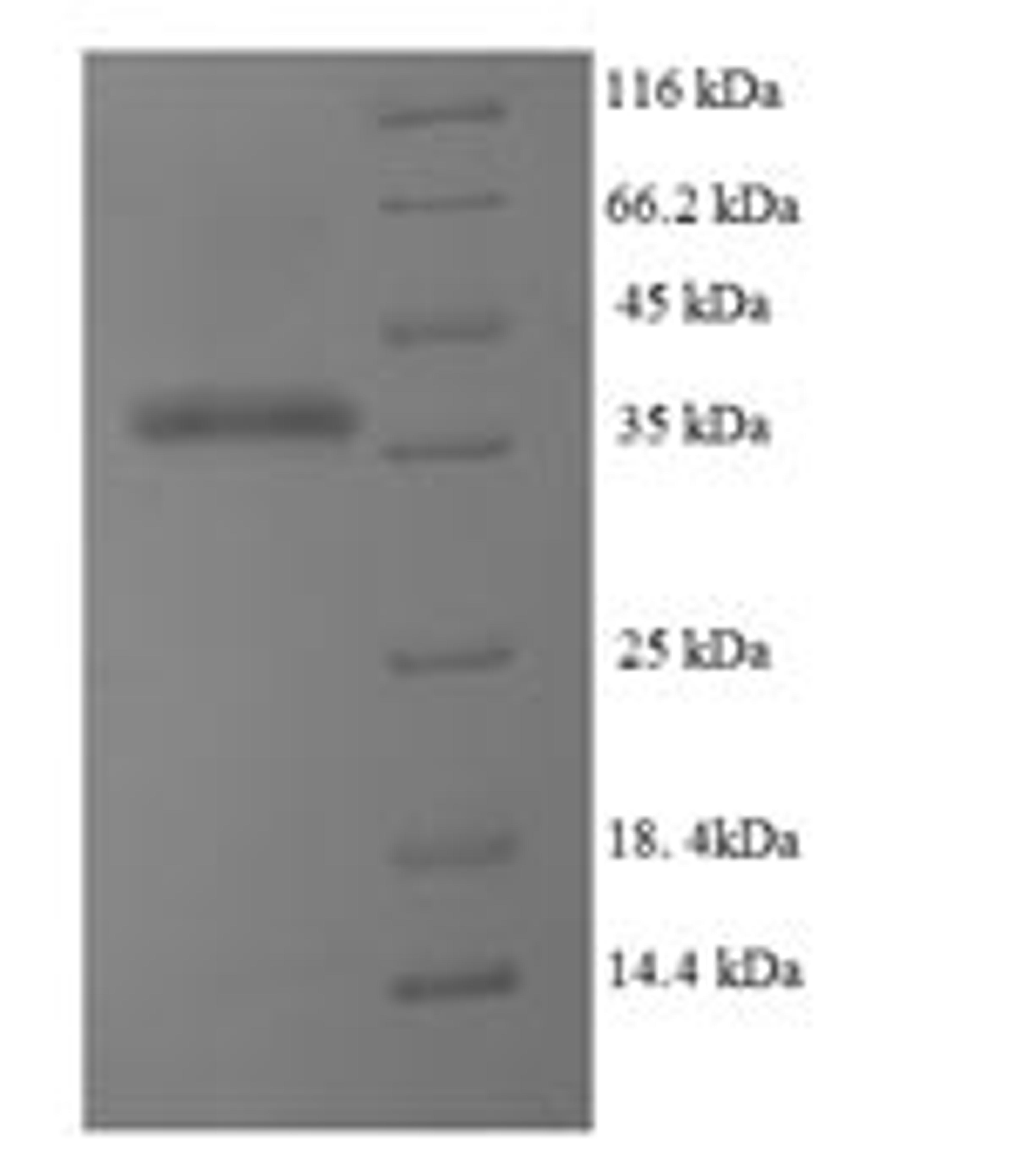 (Tris-Glycine gel) Discontinuous SDS-PAGE (reduced) with 5% enrichment gel and 15% separation gel.