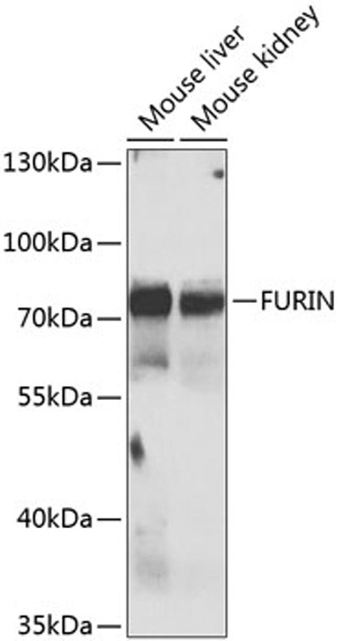 Western blot - FURIN antibody (A7445)