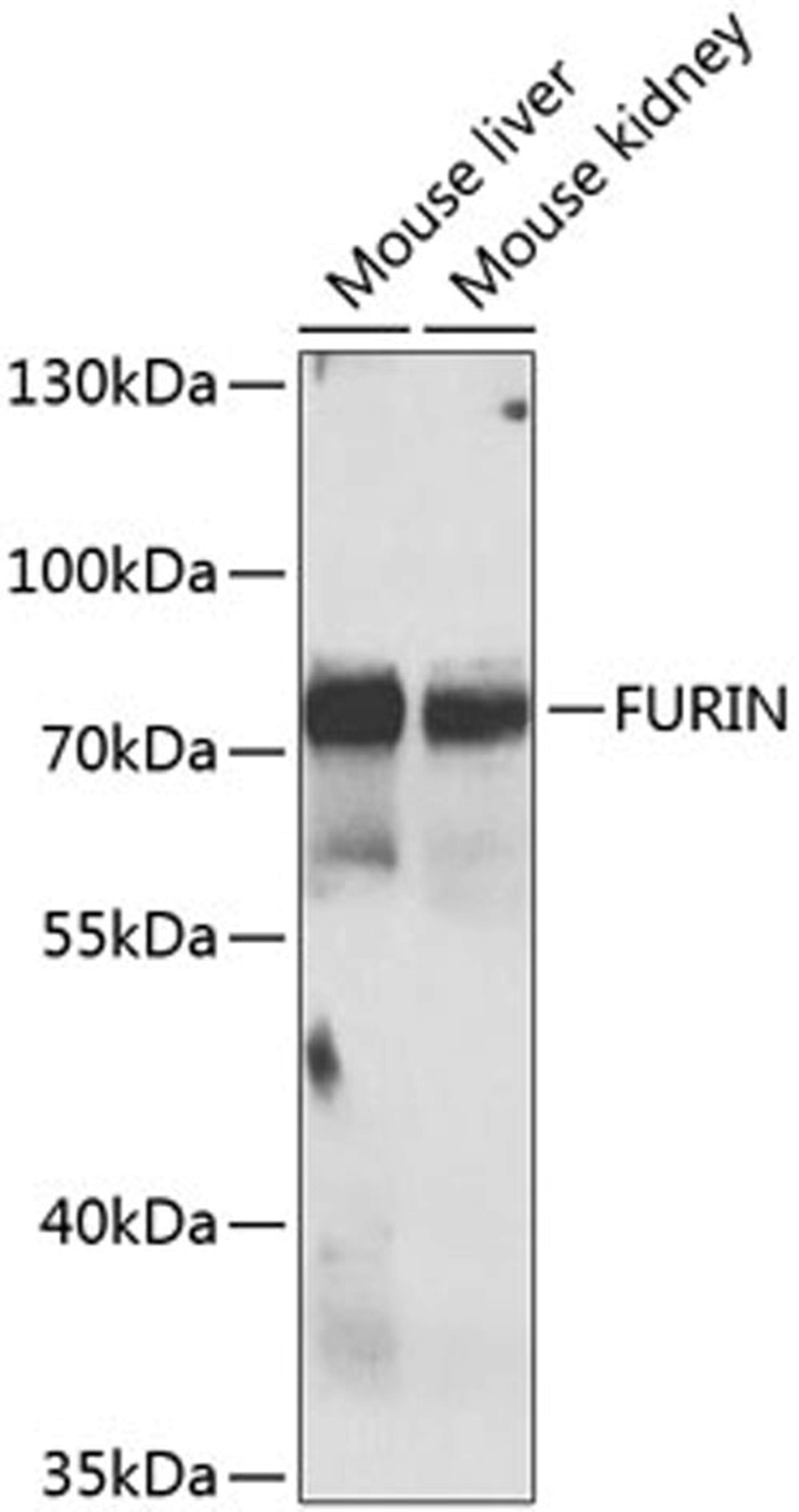 Western blot - FURIN antibody (A7445)