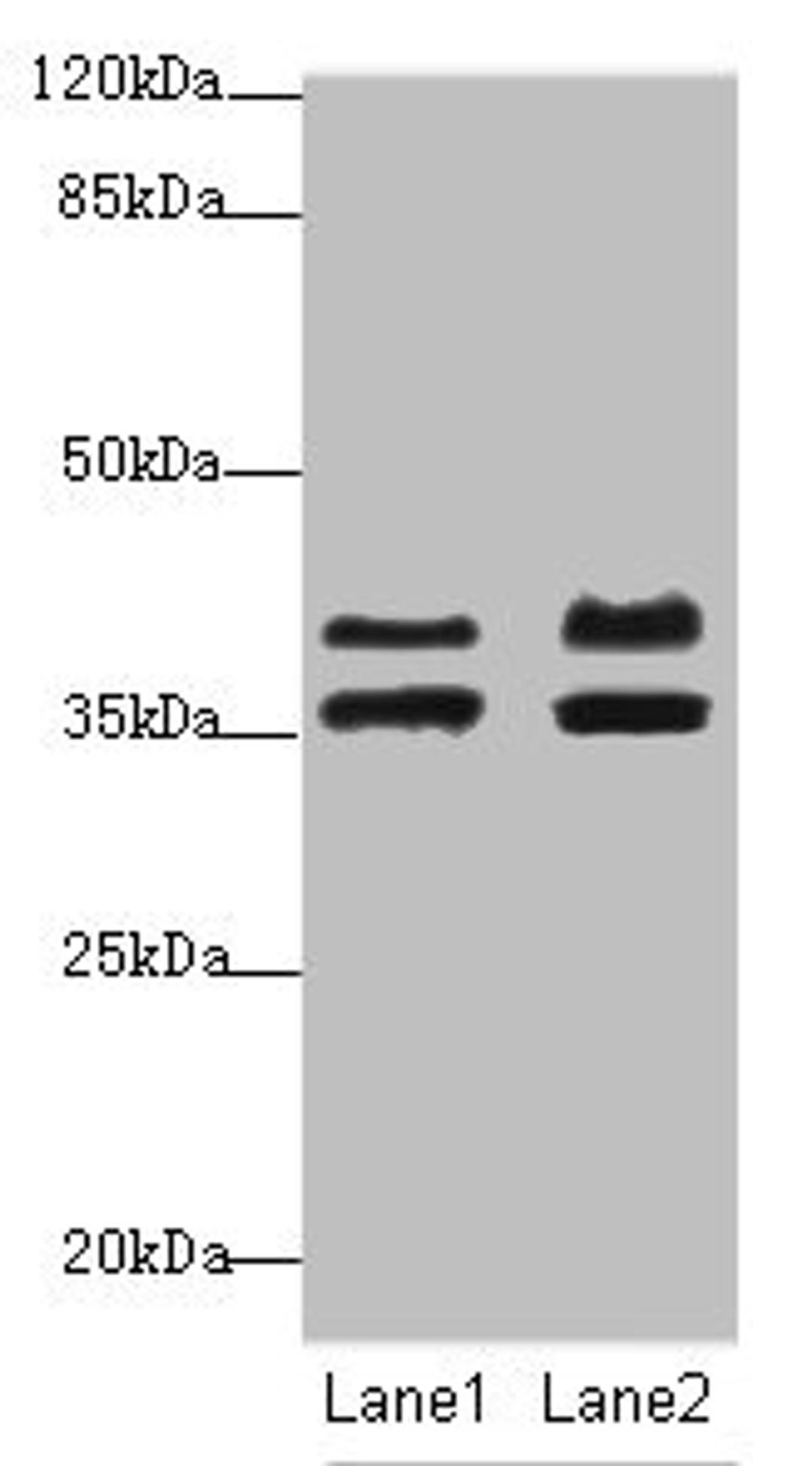 Western blot. All lanes: IKBIPantibody at 2.23ug/ml. Lane 1: Mouse kidney tissue. Lane 2: HL60 whole cell lysate. Secondary. Goat polyclonal to rabbit IgG at 1/10000 dilution. Predicted band size: 40, 28, 8, 44 kDa. Observed band size: 40, 36 kDa.