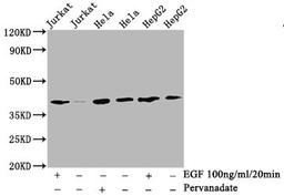 Western Blot. Positive WB detected in:Jurkat whole cell lysate, Hela whole cell lysate, HepG2 whole cell lysate(treated with EGF or Pervanadate). All lanes: Phospho-LAT antibody at 2.9μg/ml. Secondary. Goat polyclonal to rabbit IgG at 1/50000 dilution. Predicted band size: 38 KDa. Observed band size: 38 KDa