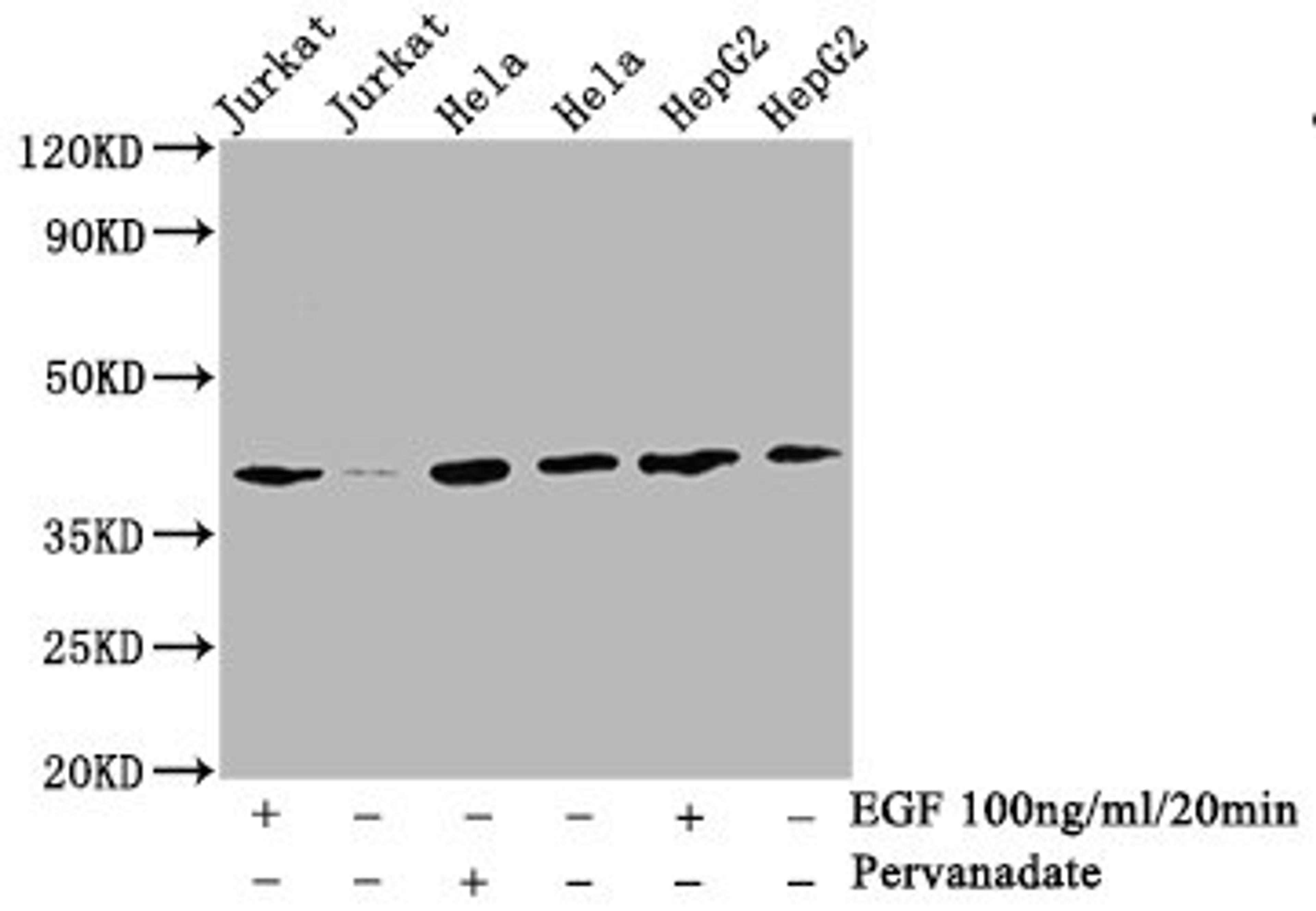 Western Blot. Positive WB detected in:Jurkat whole cell lysate, Hela whole cell lysate, HepG2 whole cell lysate(treated with EGF or Pervanadate). All lanes: Phospho-LAT antibody at 2.9μg/ml. Secondary. Goat polyclonal to rabbit IgG at 1/50000 dilution. Predicted band size: 38 KDa. Observed band size: 38 KDa