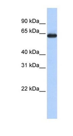 Western blot analysis of human Lung tissue using SLC34A3 antibody