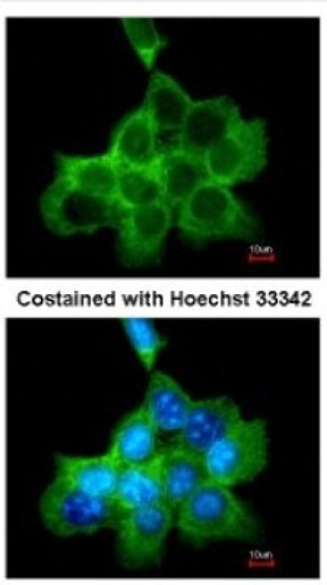 Immunocytochemistry/Immunofluorescence: DOCK1 Antibody [NBP1-30945] - Analysis of methanol-fixed A431, using antibody at 1:200 dilution.