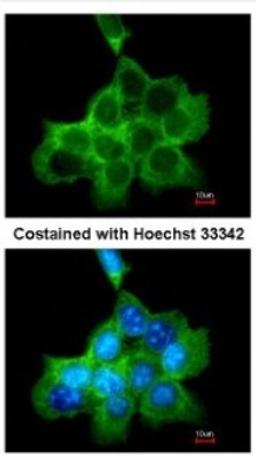 Immunocytochemistry/Immunofluorescence: DOCK1 Antibody [NBP1-30945] - Analysis of methanol-fixed A431, using antibody at 1:200 dilution.